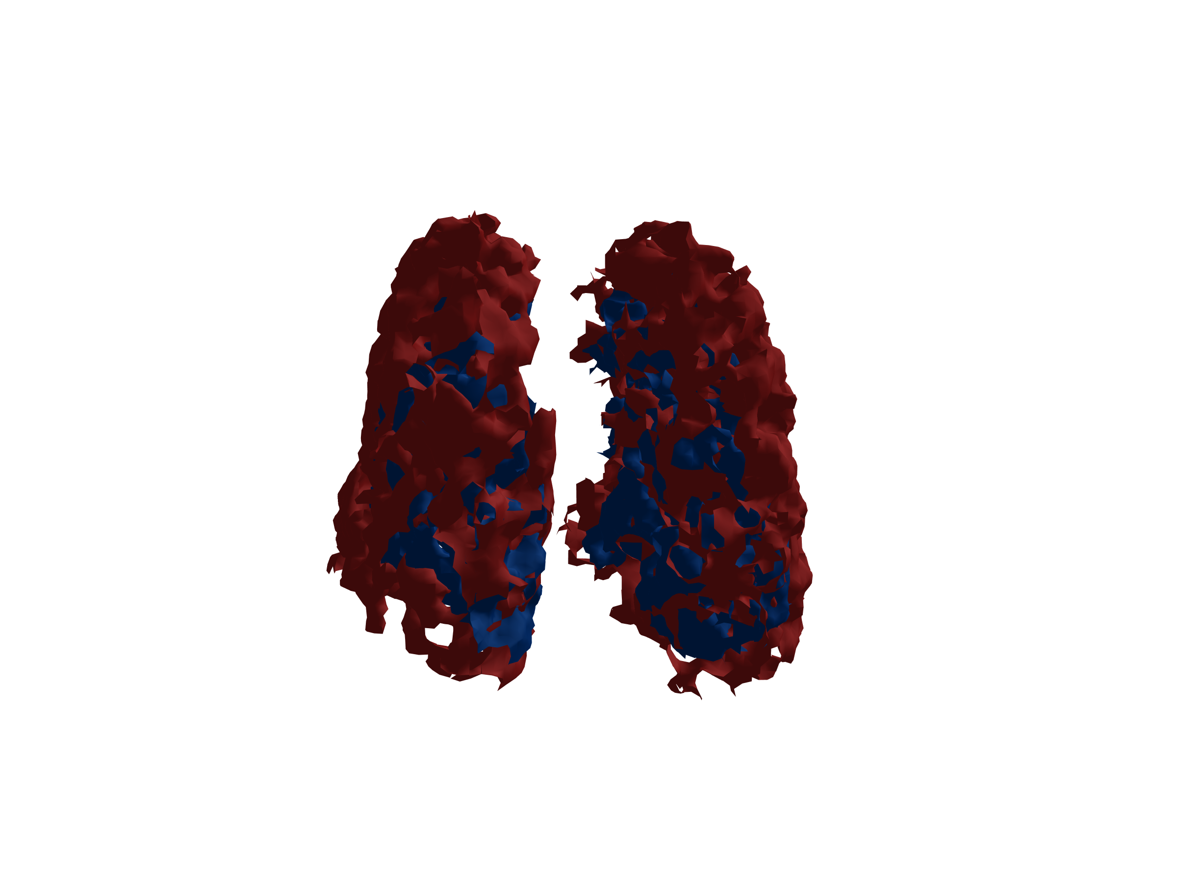 3D Lung Visualization