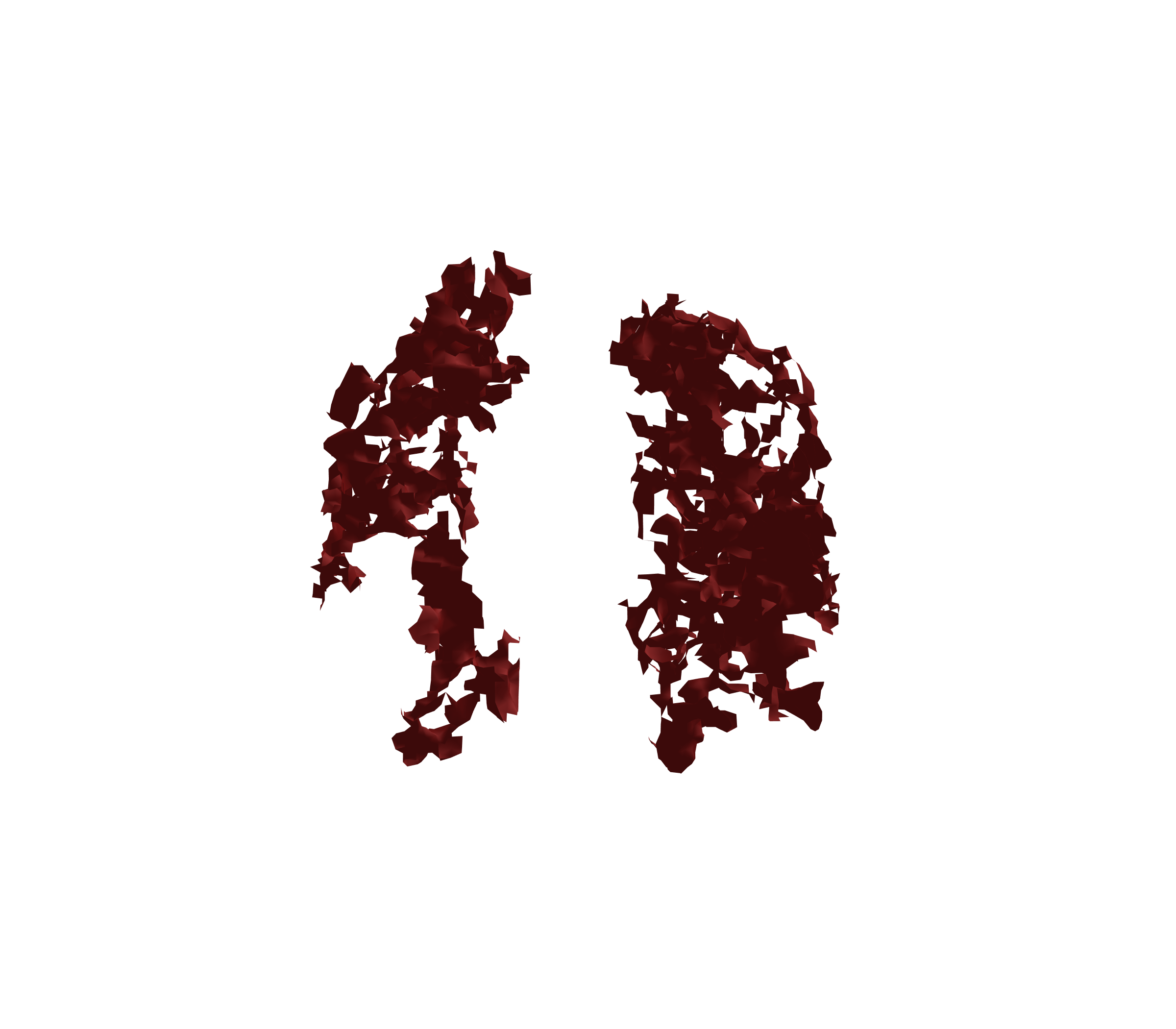 Surface Mesh (Expiration) - Front View