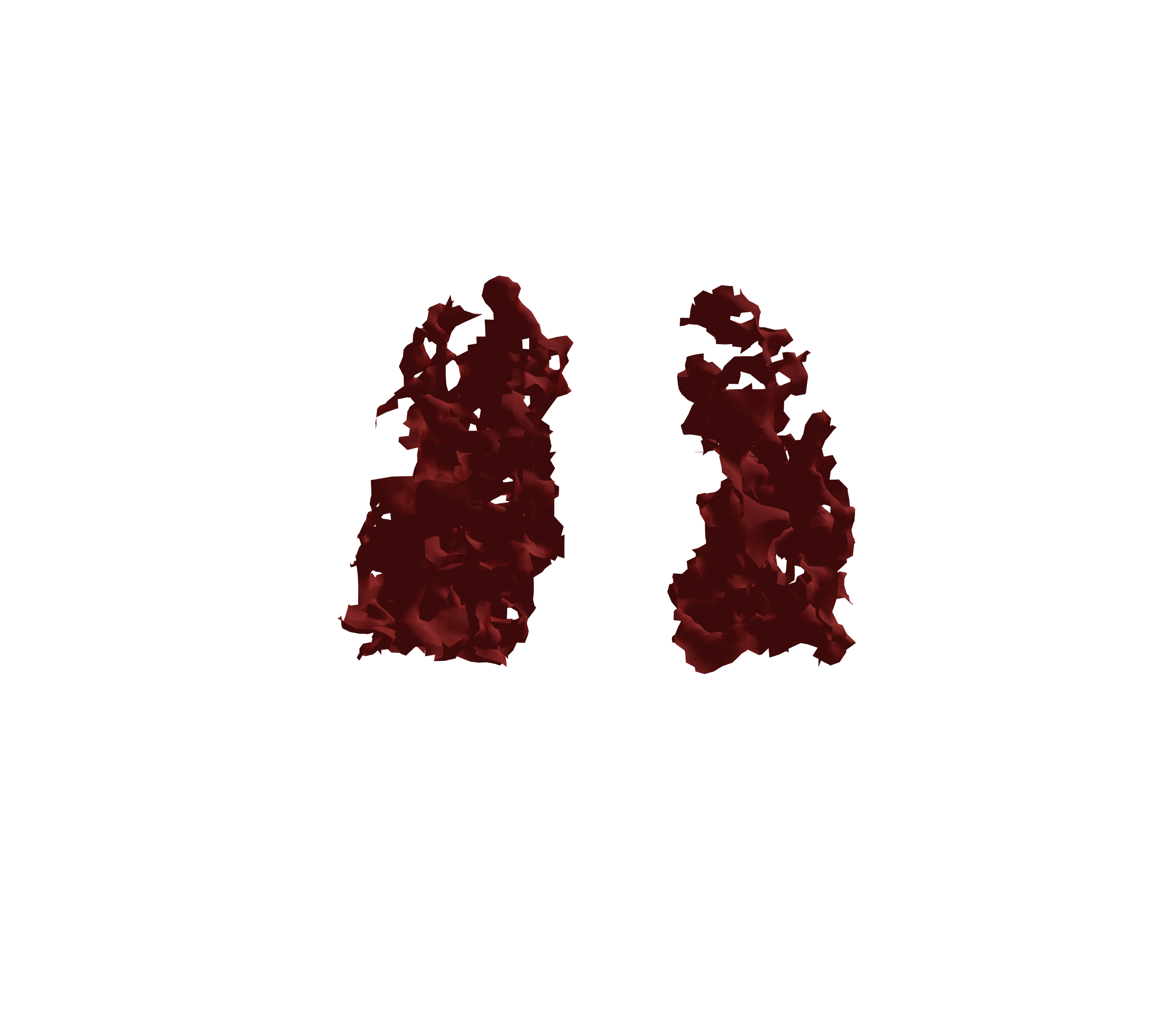 Surface Mesh (Expiration) - Back View