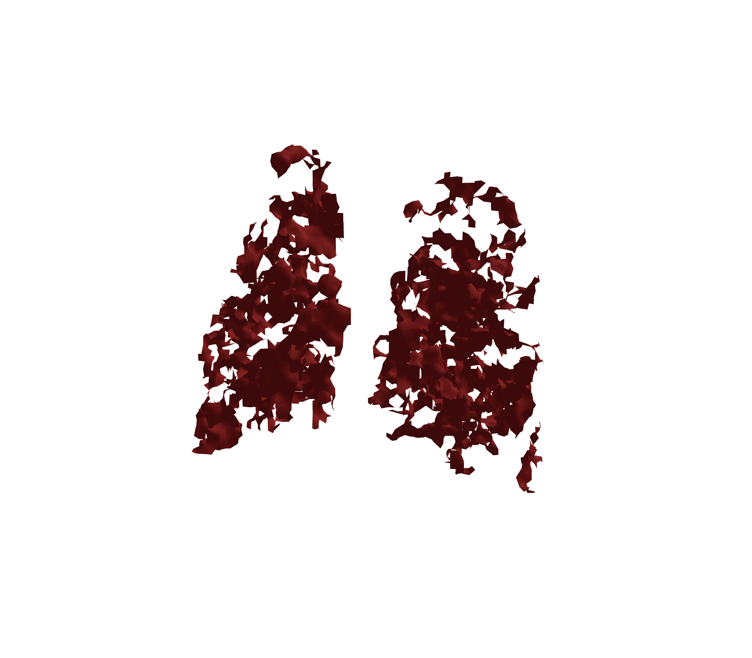 Surface Mesh (Expiration) - Back View