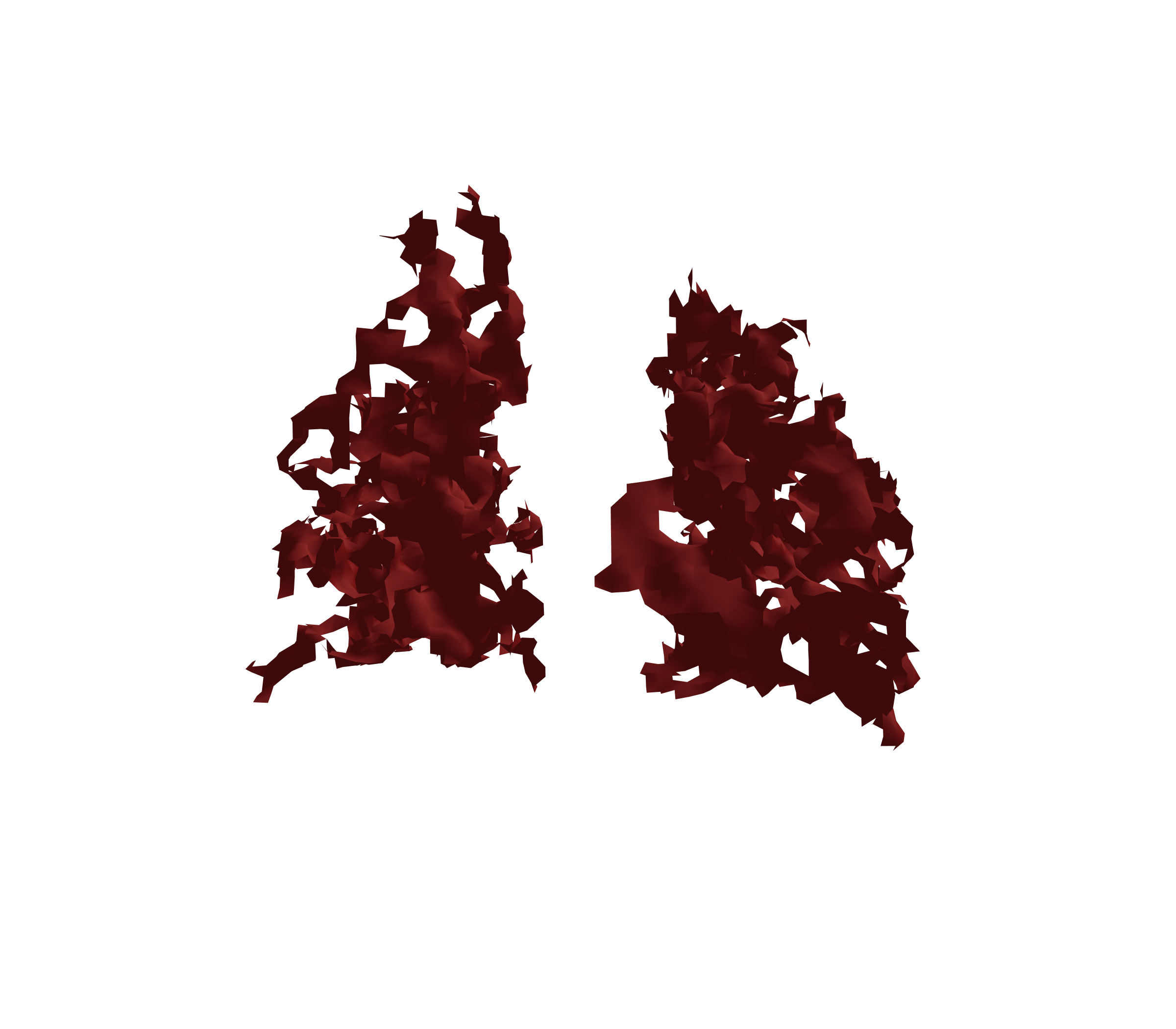 Surface Mesh (Expiration) - Back View