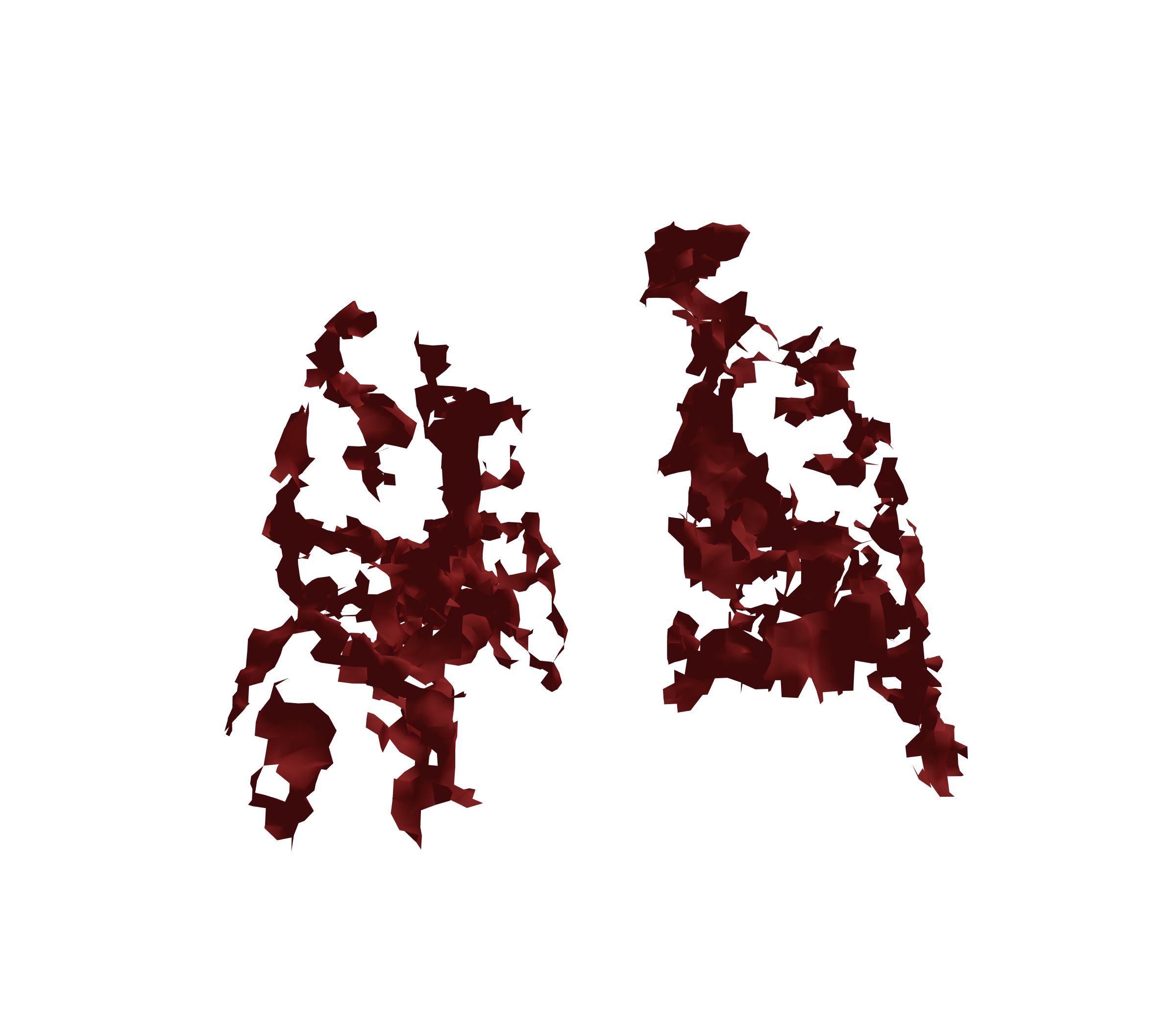 Surface Mesh (Expiration) - Back View