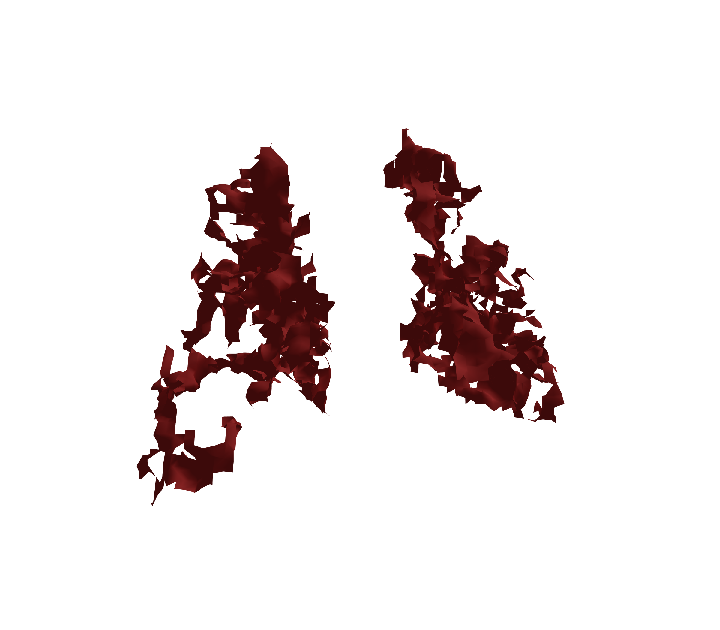 Surface Mesh (Expiration) - Back View