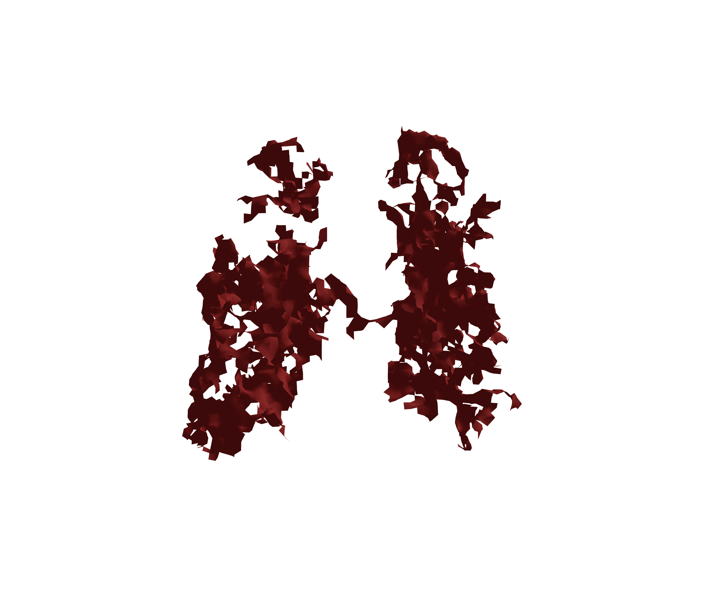 Surface Mesh (Expiration) - Back View