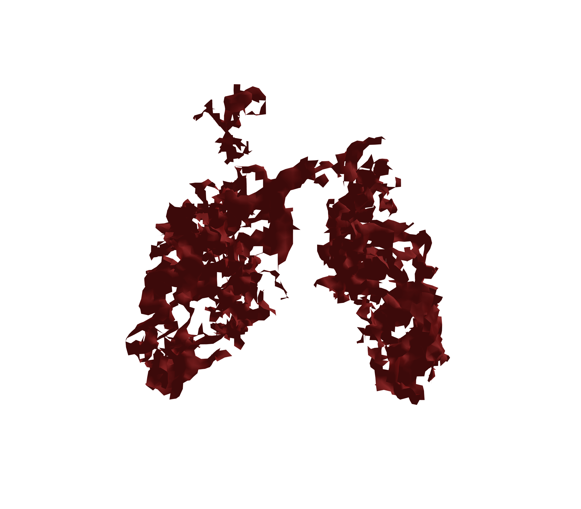 Surface Mesh (Expiration) - Back View