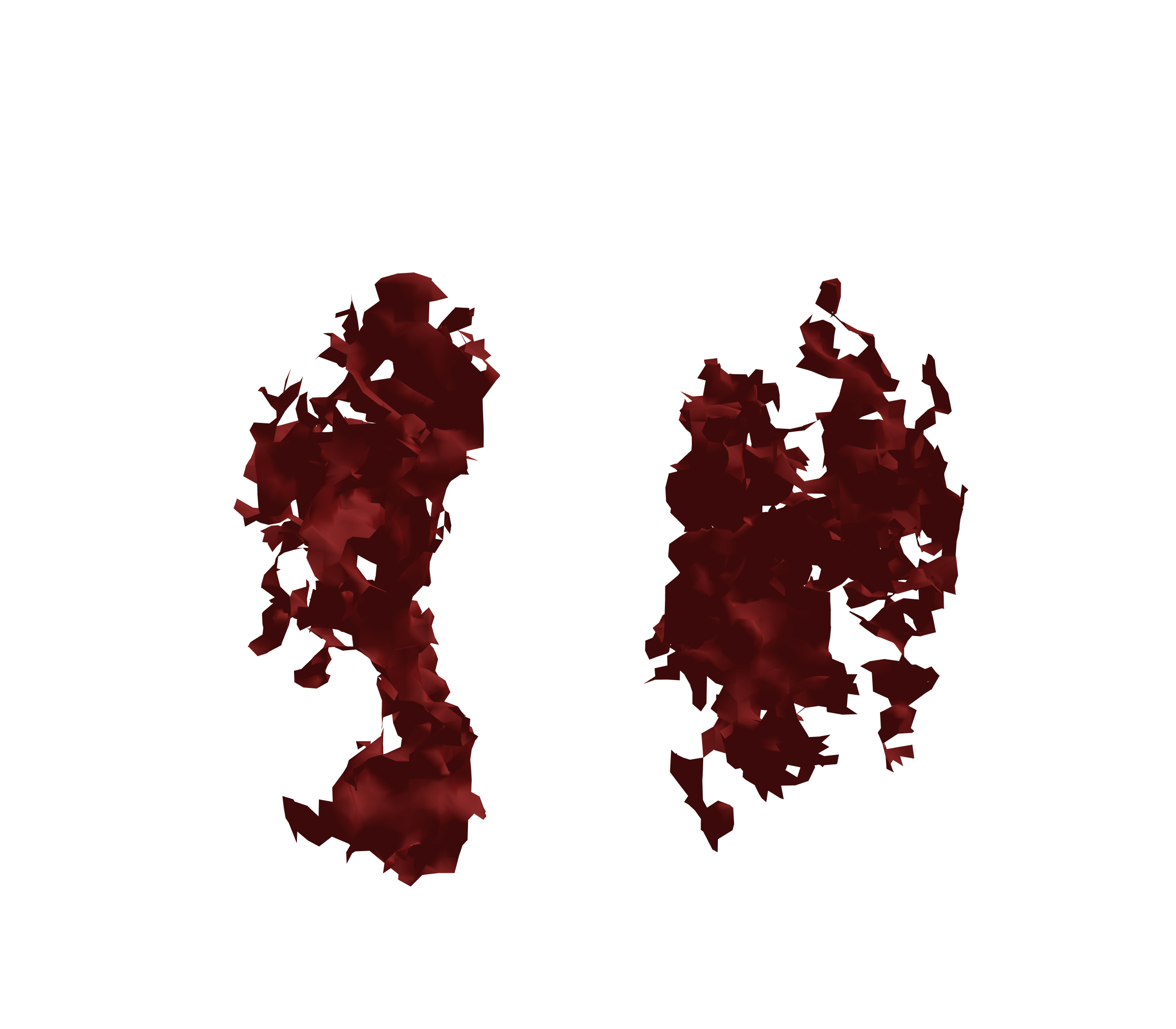 Surface Mesh (Expiration) - Front View