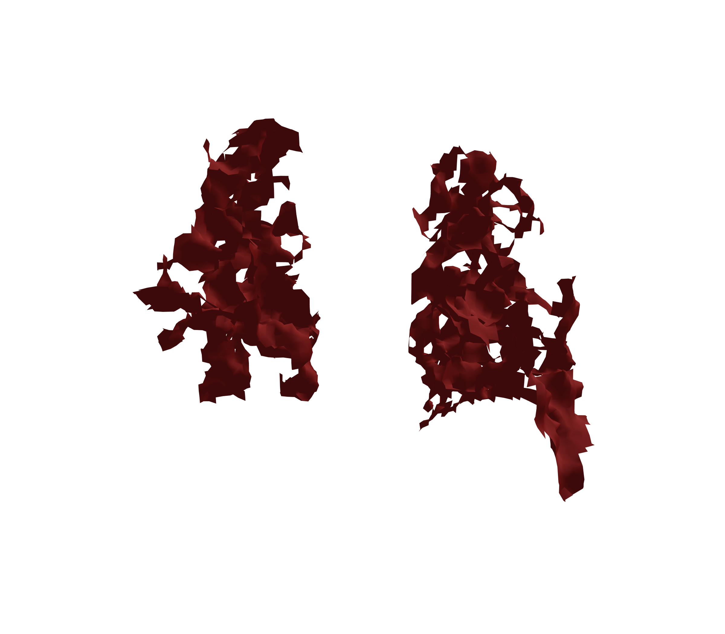 Surface Mesh (Expiration) - Back View