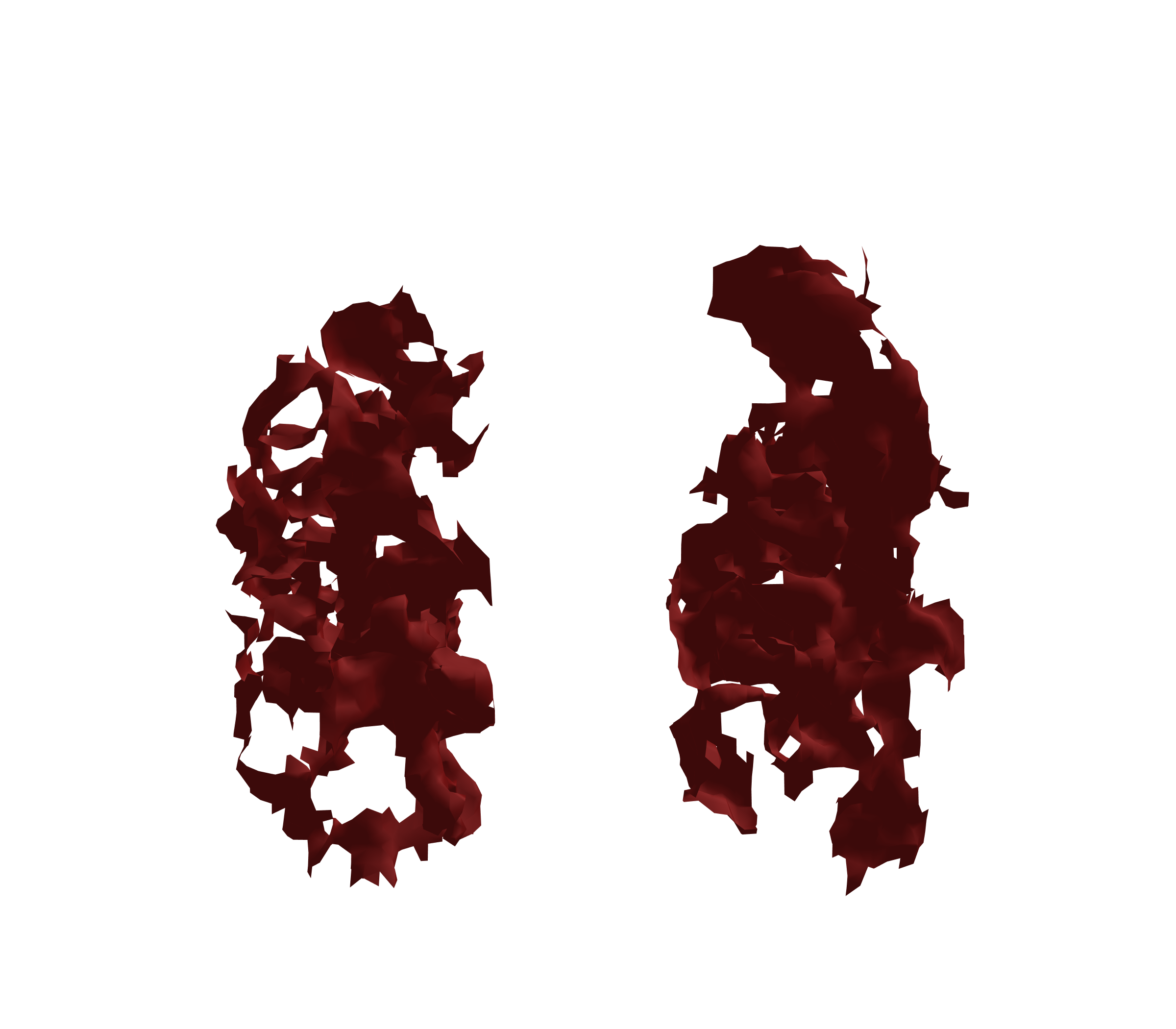 Surface Mesh (Expiration) - Front View