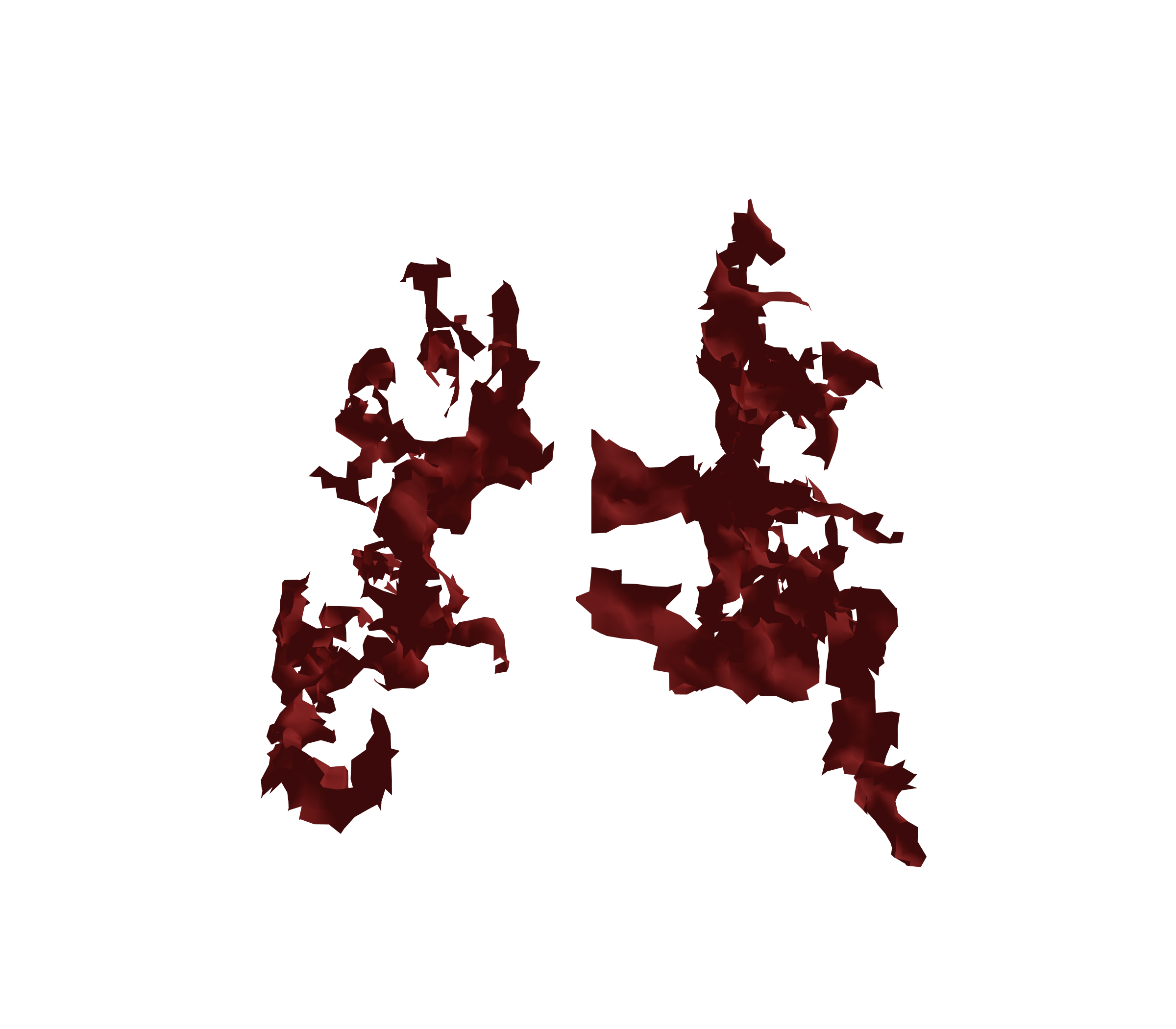 Surface Mesh (Expiration) - Back View