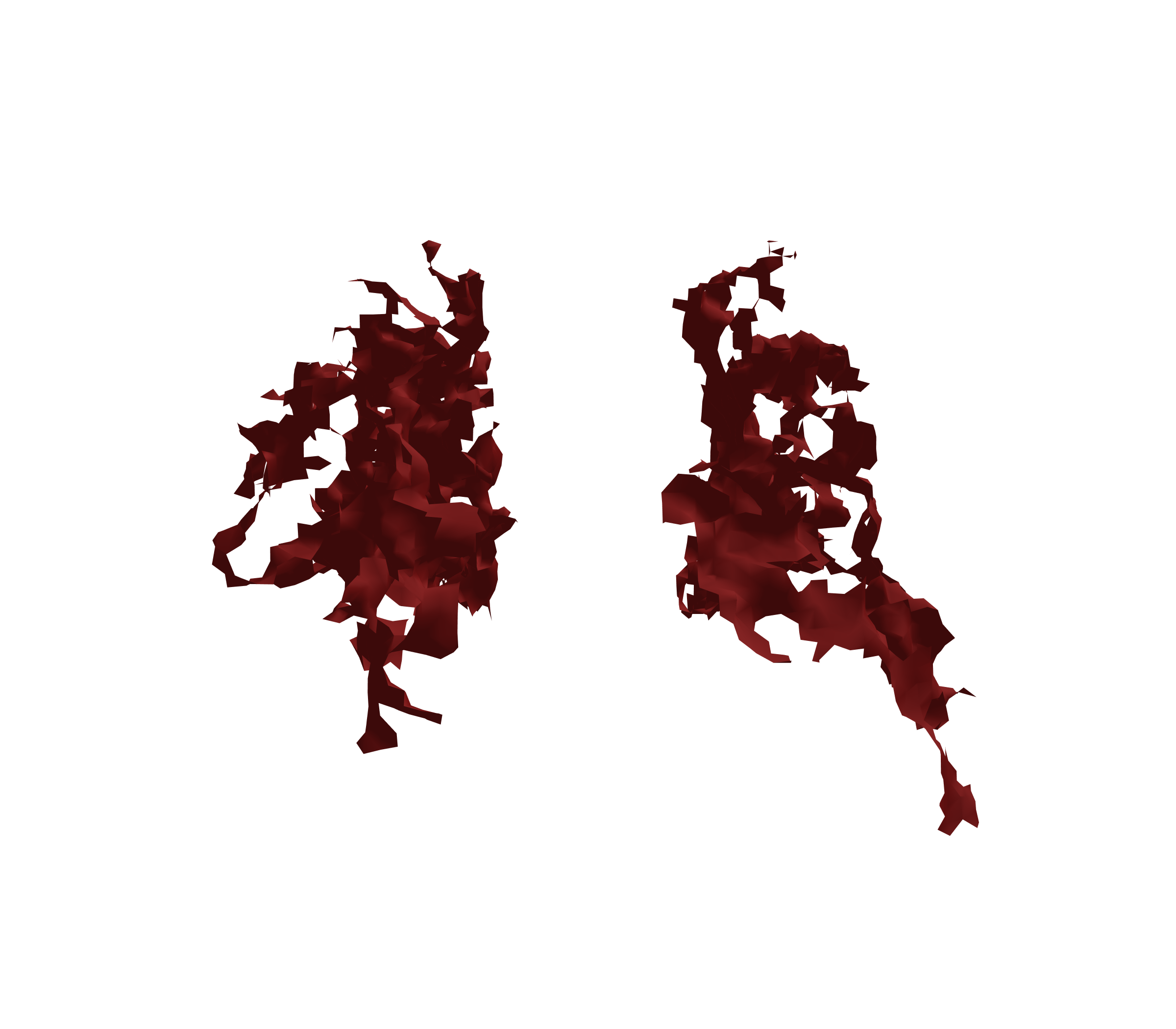 Surface Mesh (Expiration) - Back View