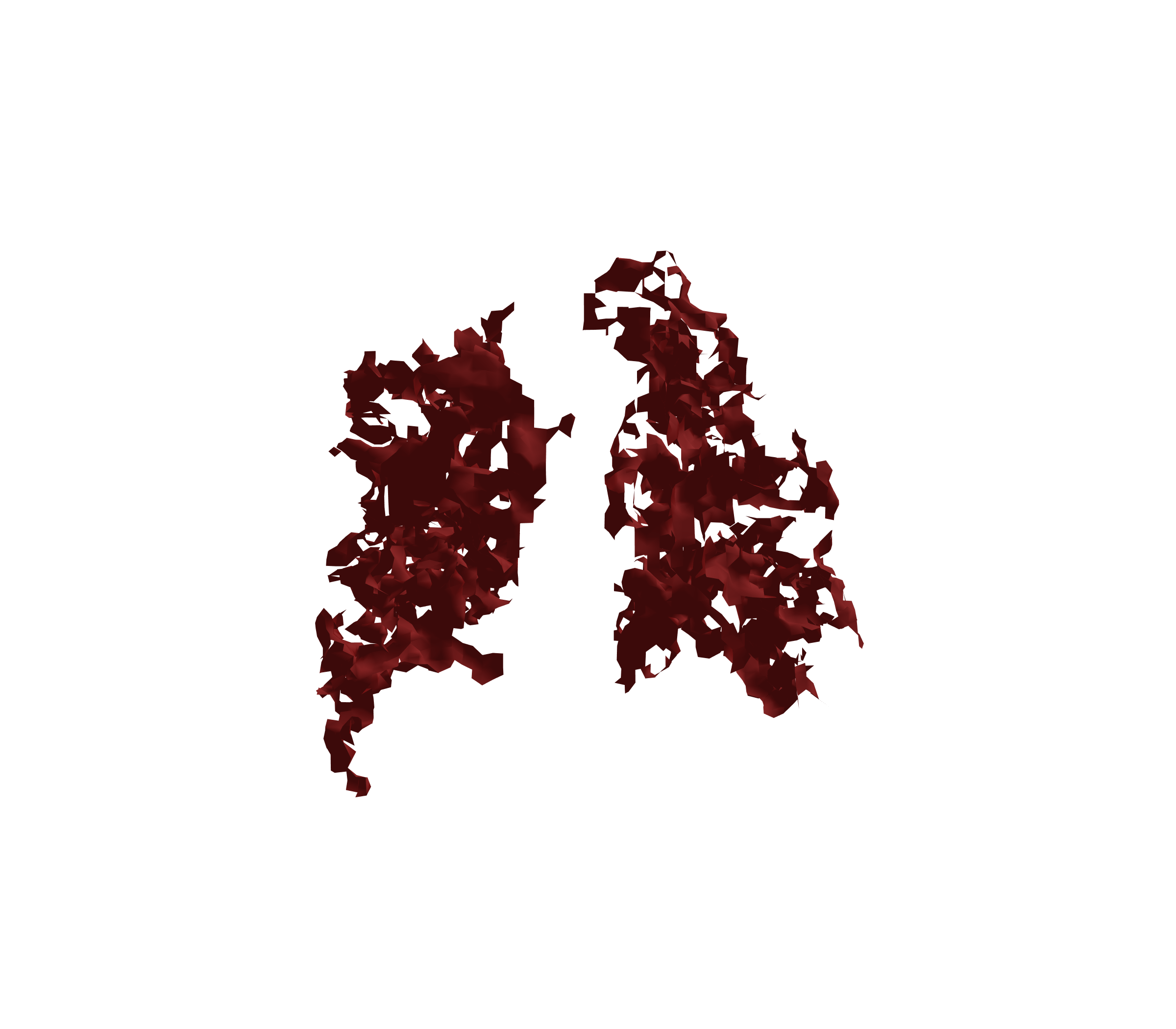 Surface Mesh (Expiration) - Back View