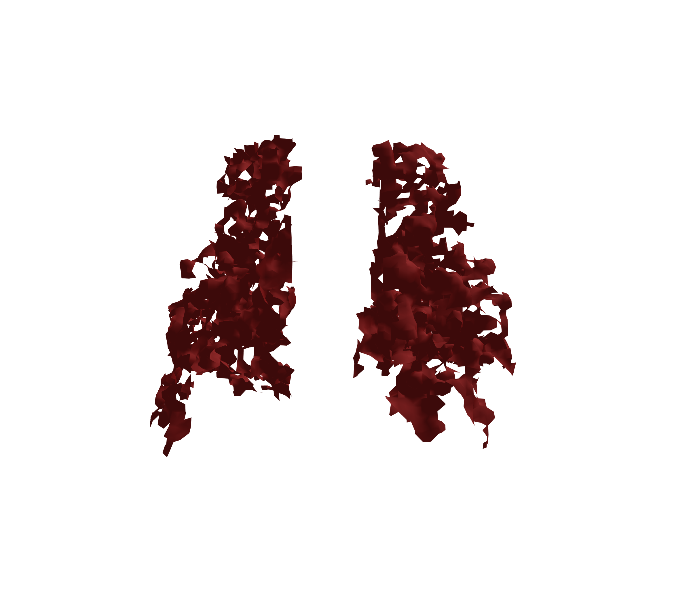 Surface Mesh (Expiration) - Back View