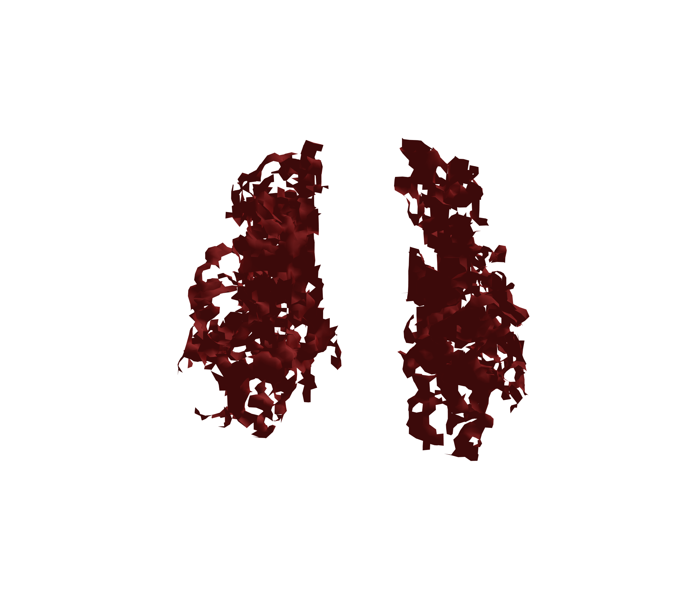 Surface Mesh (Expiration) - Front View