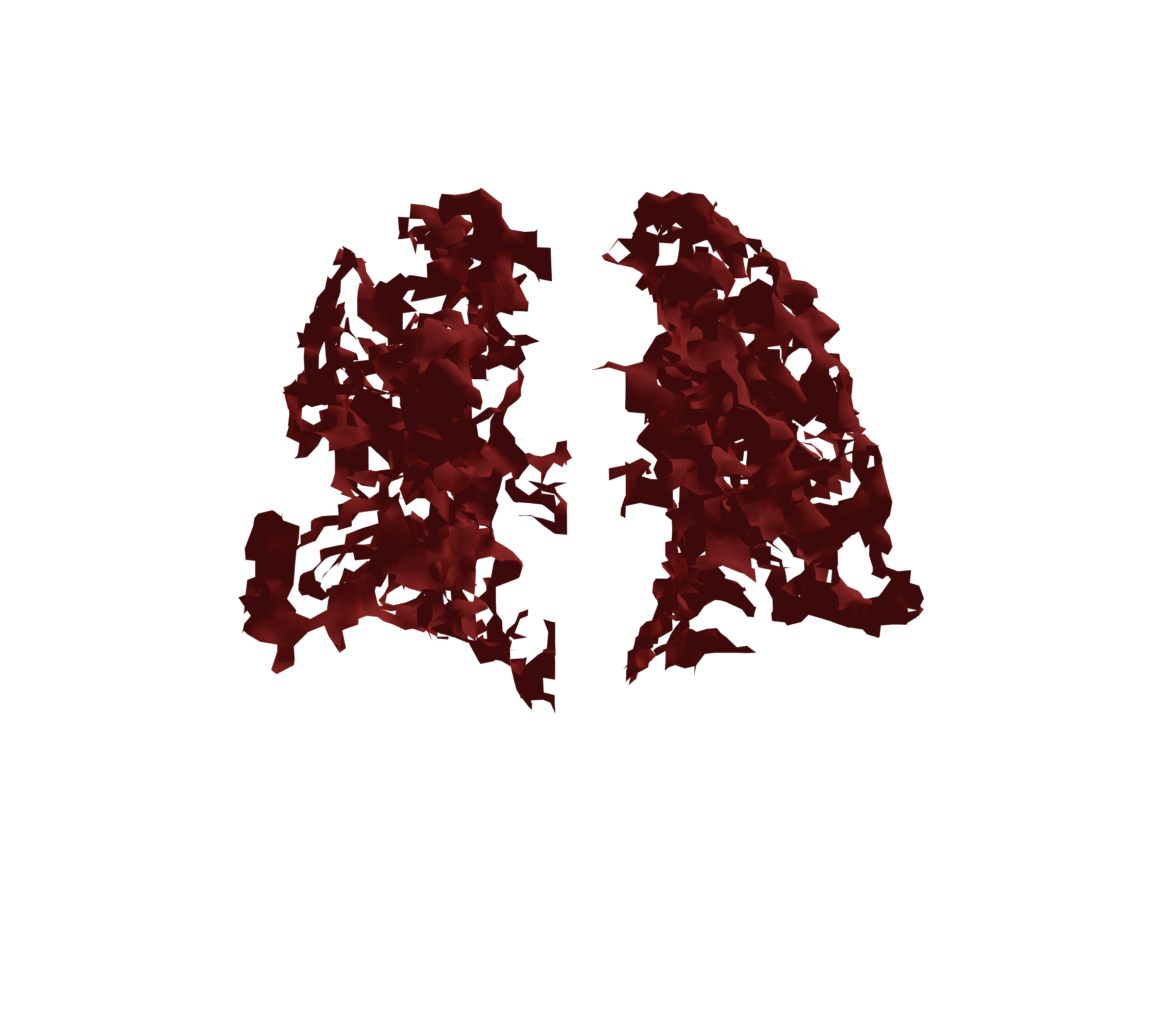 Surface Mesh (Expiration) - Back View