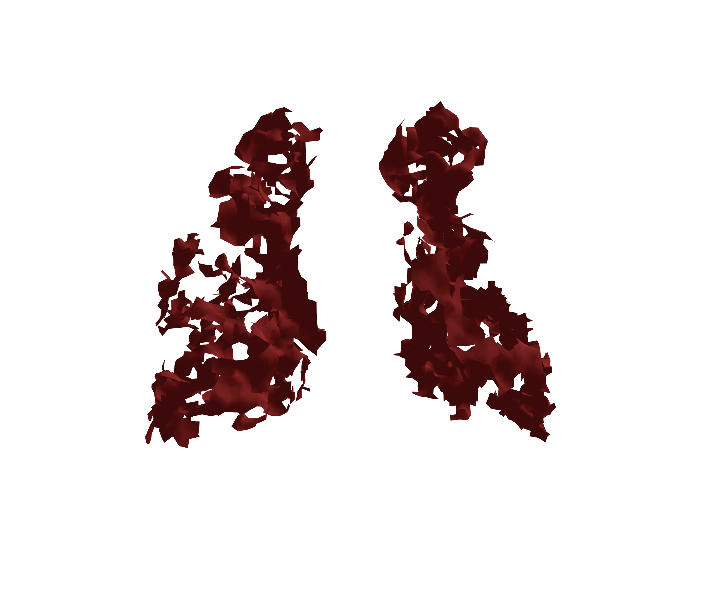 Surface Mesh (Expiration) - Back View