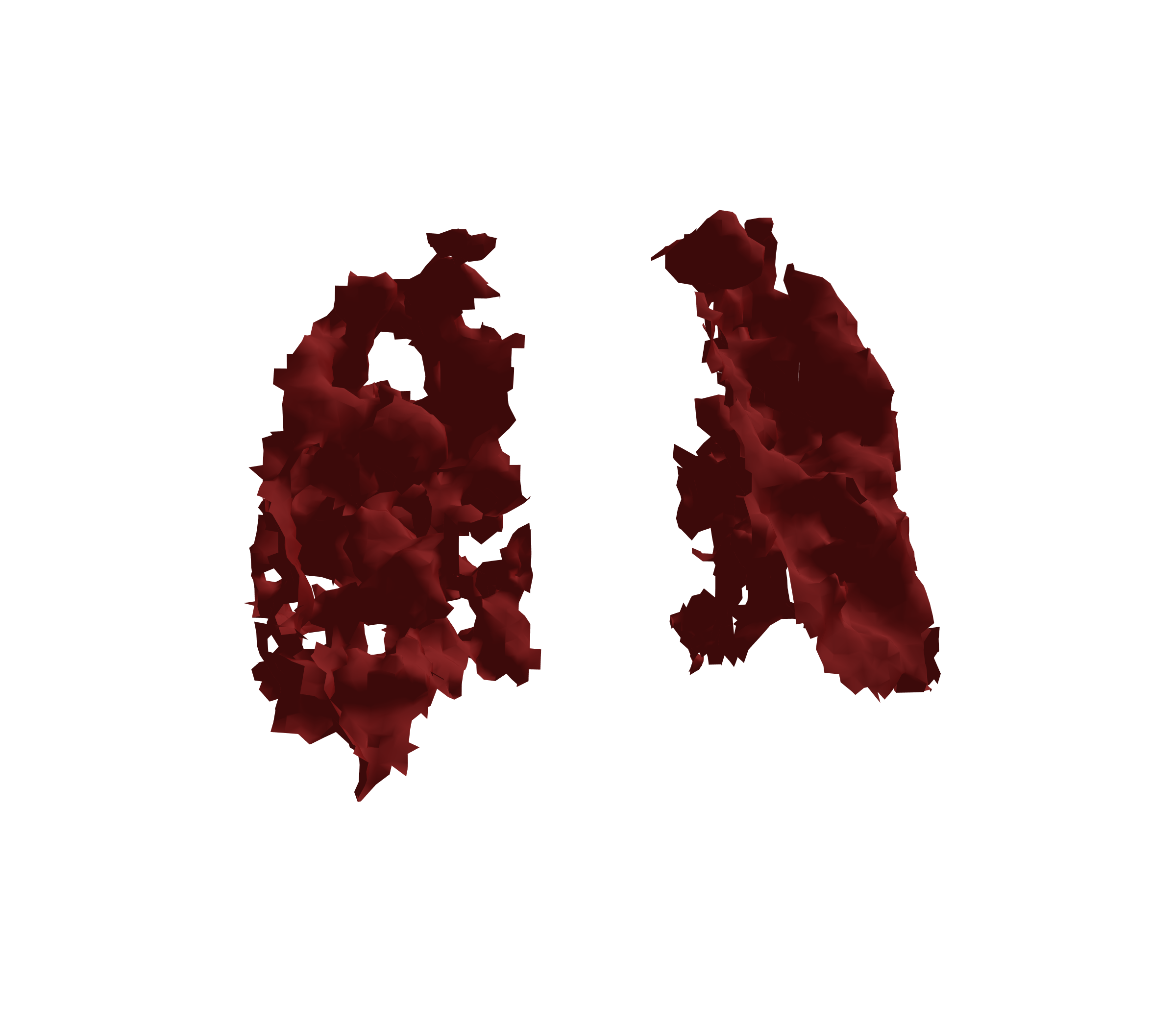 Surface Mesh (Expiration) - Back View