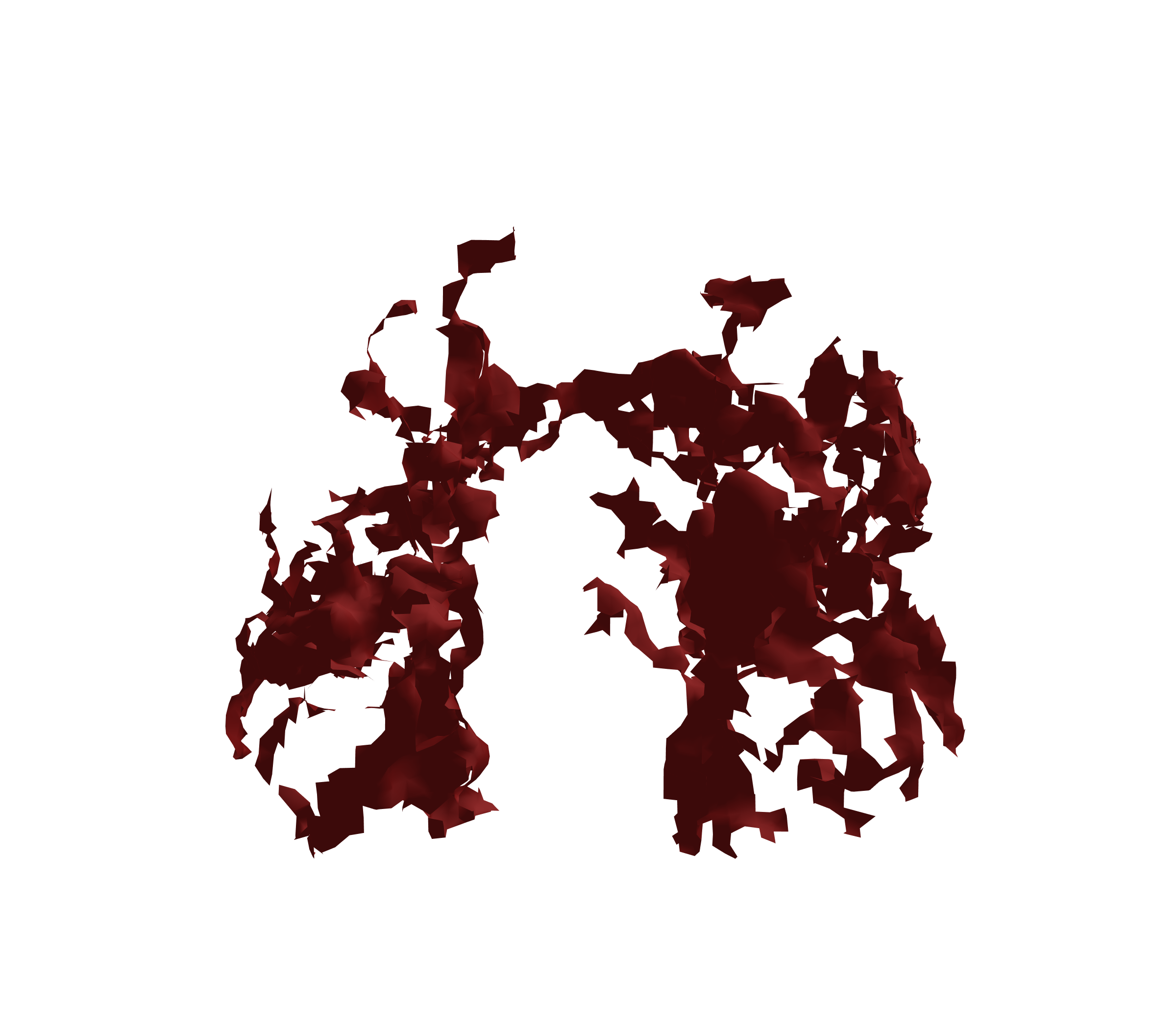 Surface Mesh (Expiration) - Front View