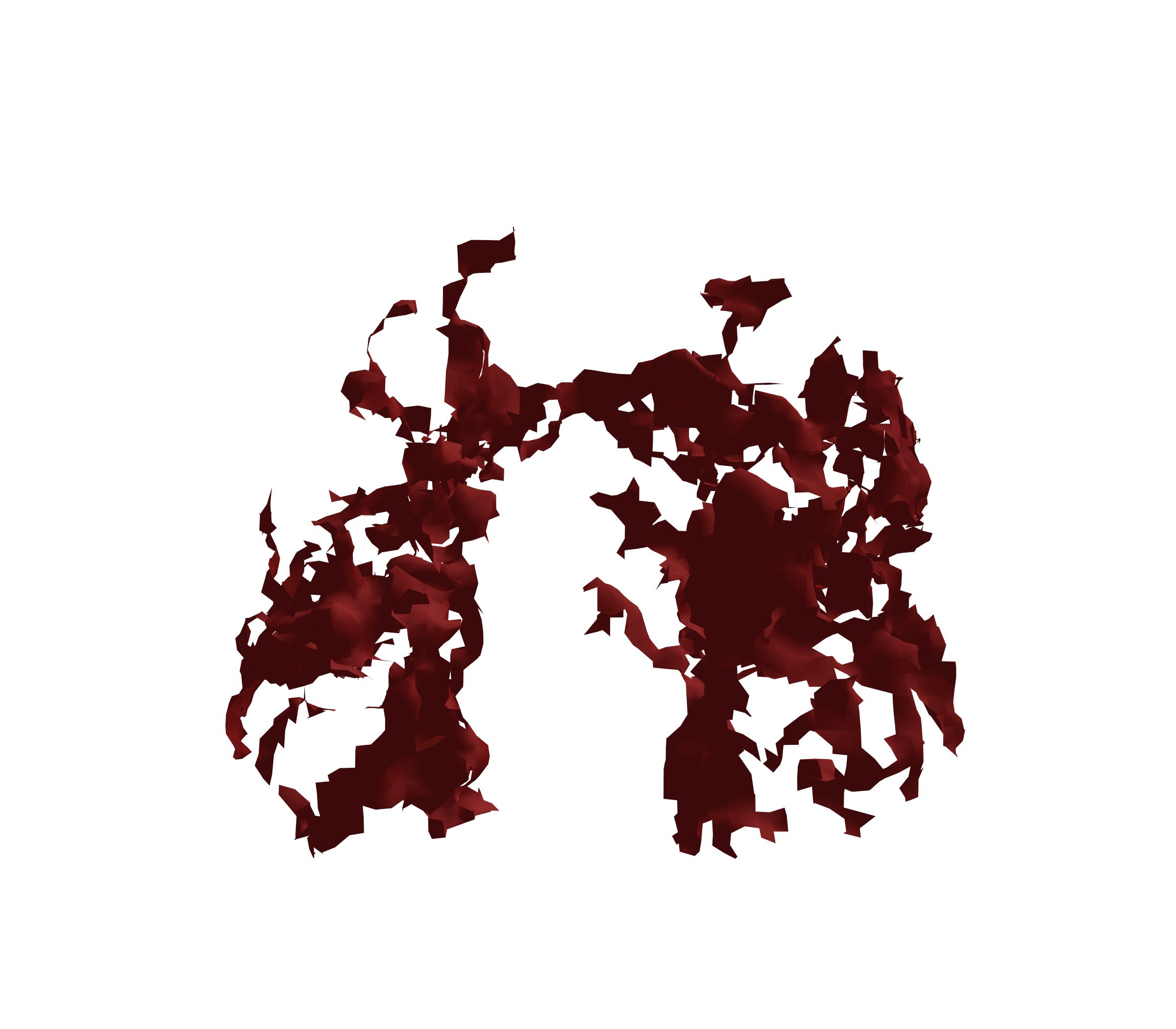 Surface Mesh (Expiration) - Front View