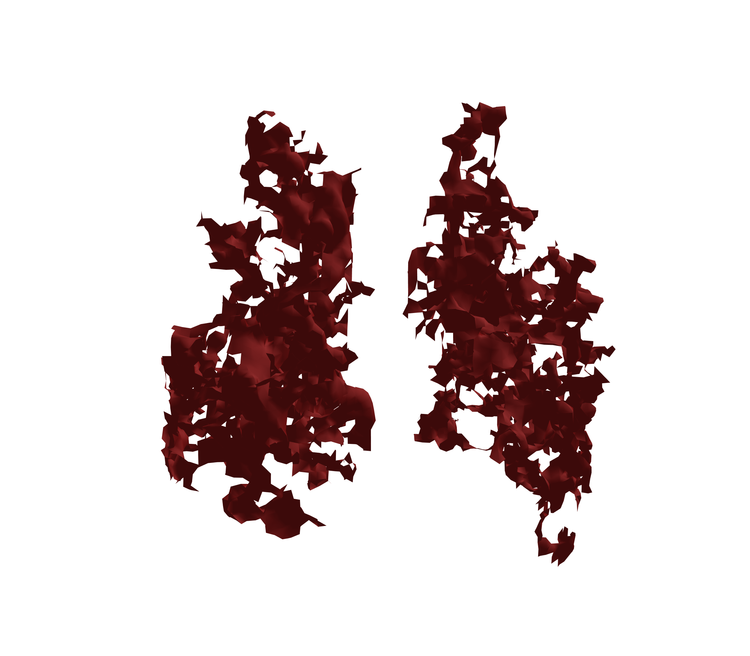 Surface Mesh (Expiration) - Back View