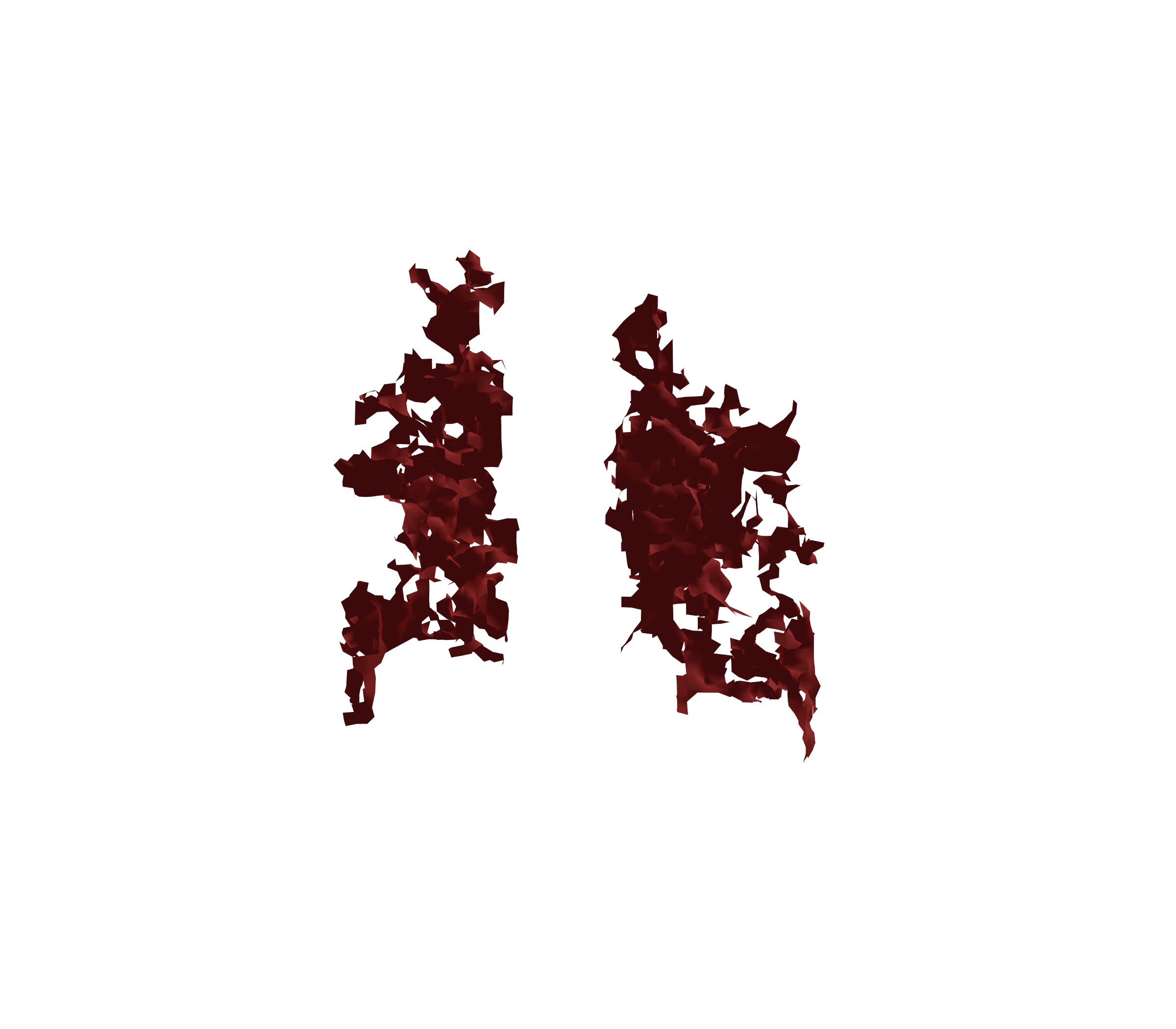 Surface Mesh (Expiration) - Back View