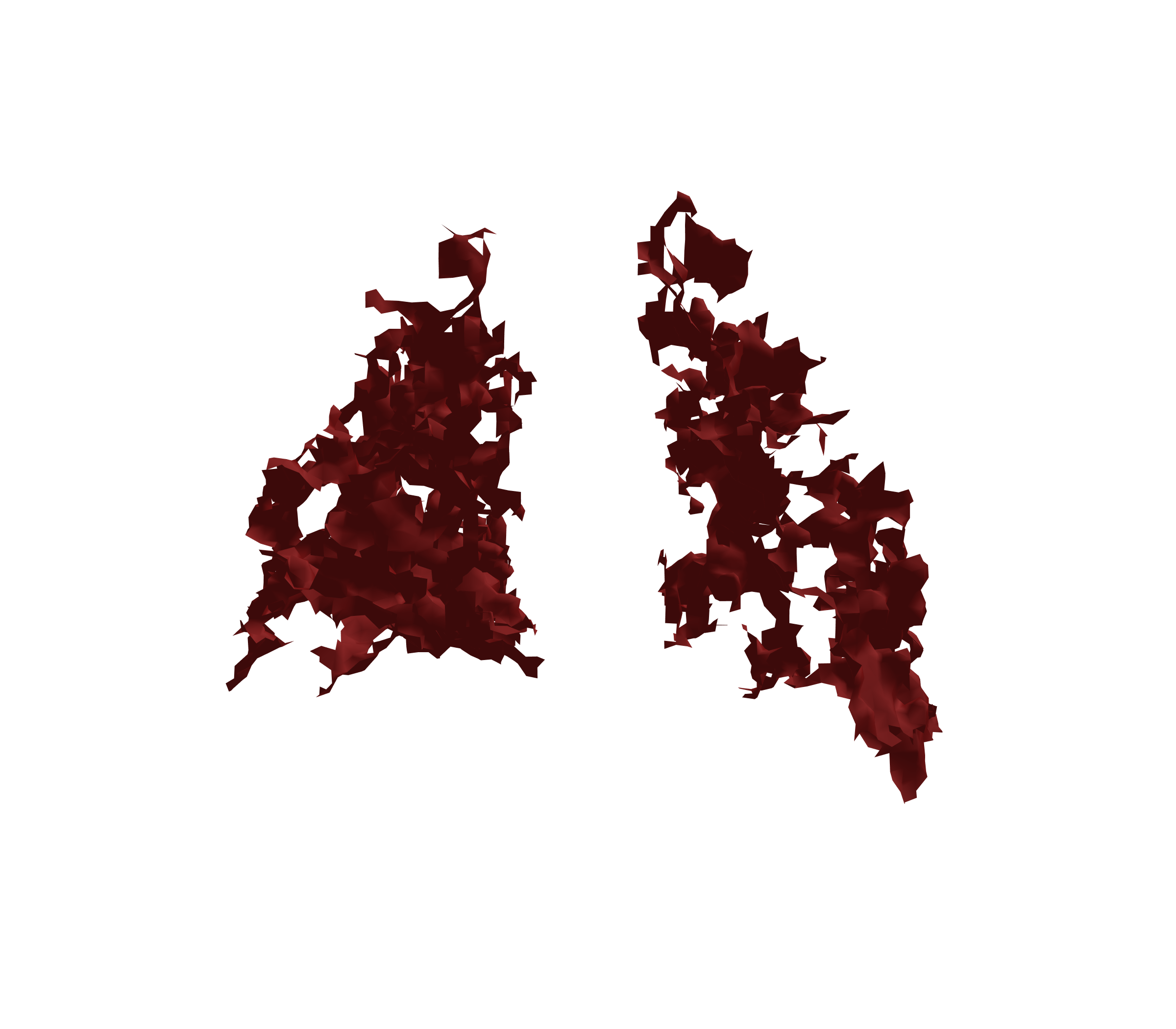 Surface Mesh (Expiration) - Back View