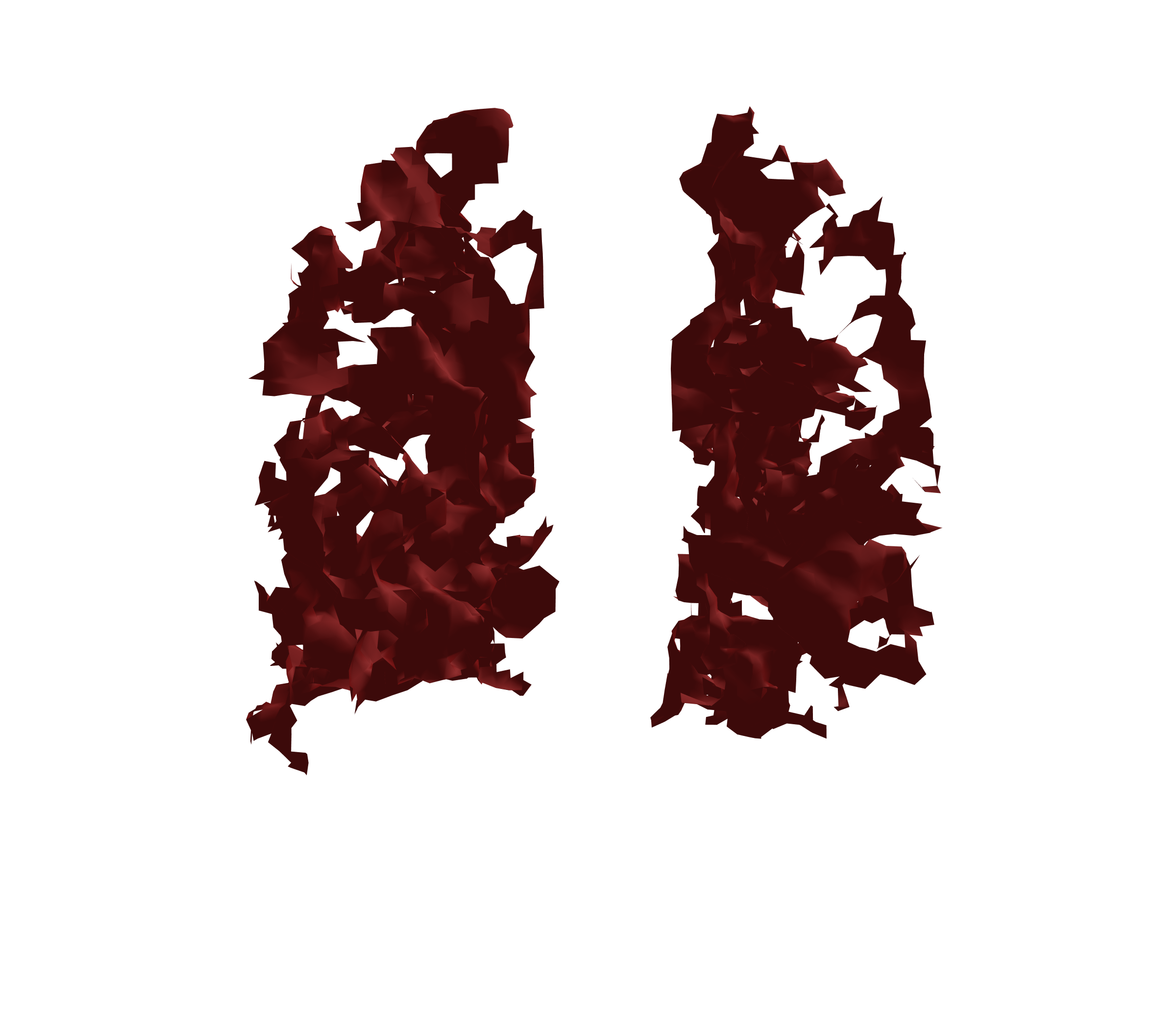 Surface Mesh (Expiration) - Back View