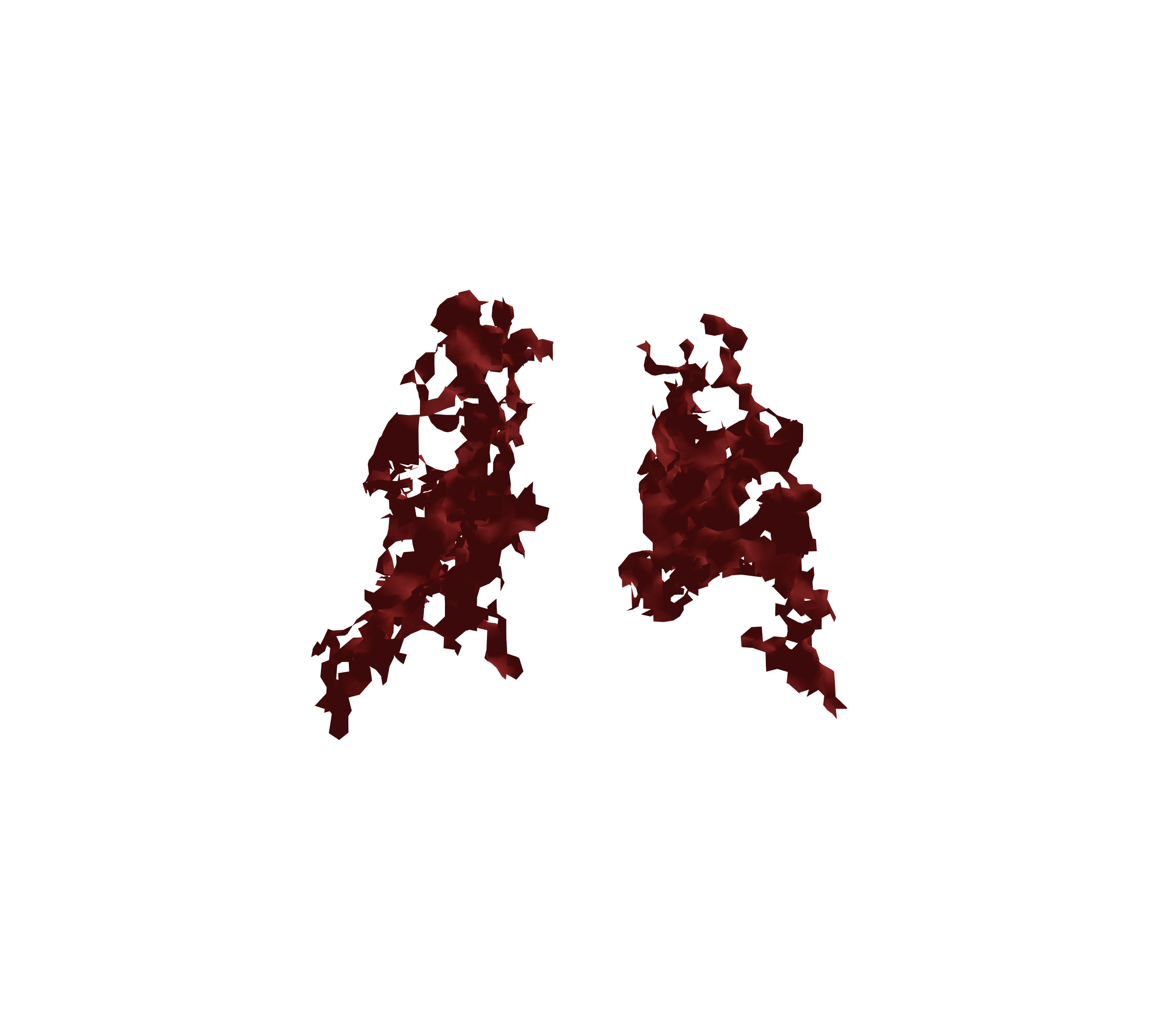 Surface Mesh (Expiration) - Back View