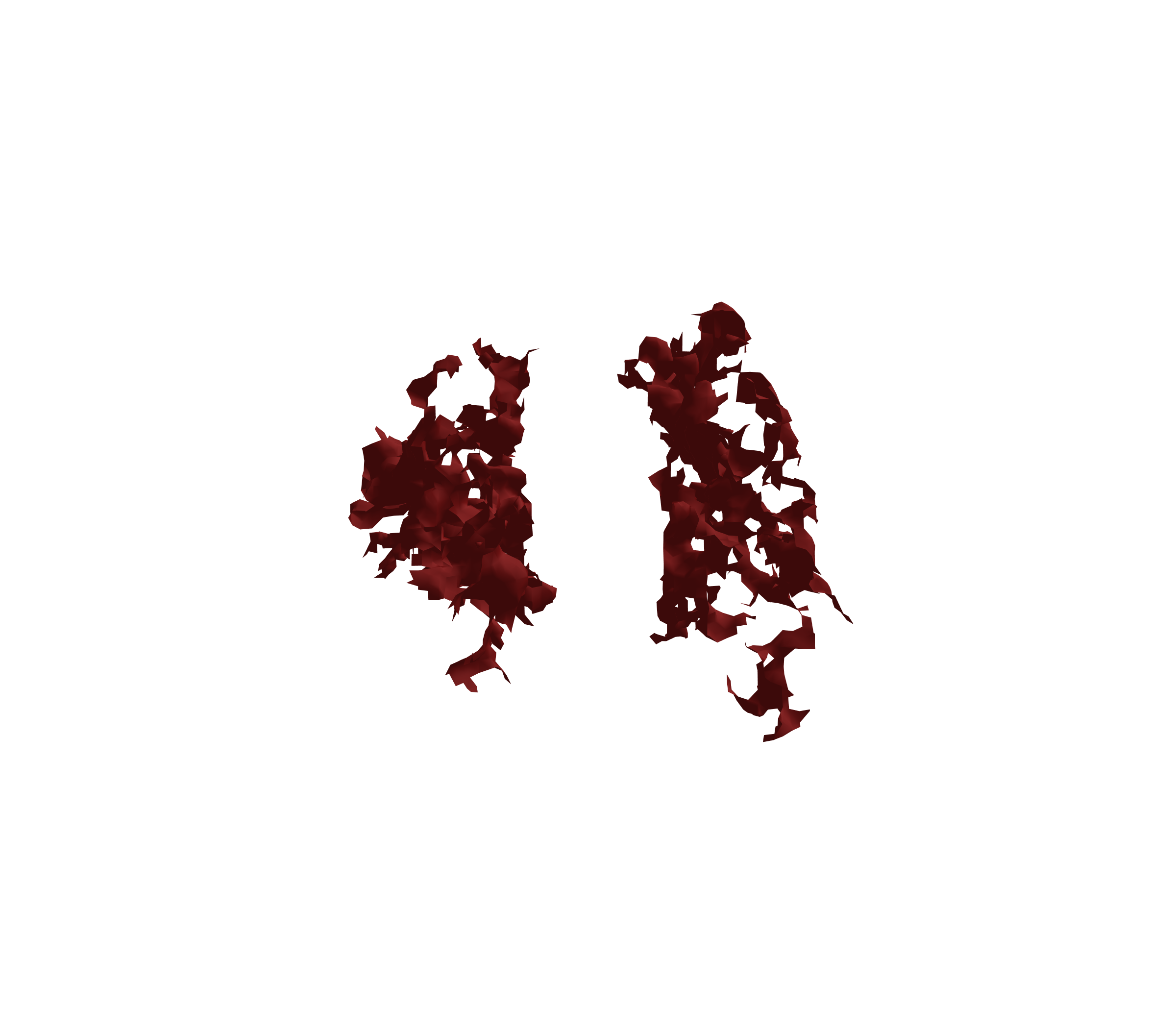 Surface Mesh (Expiration) - Front View