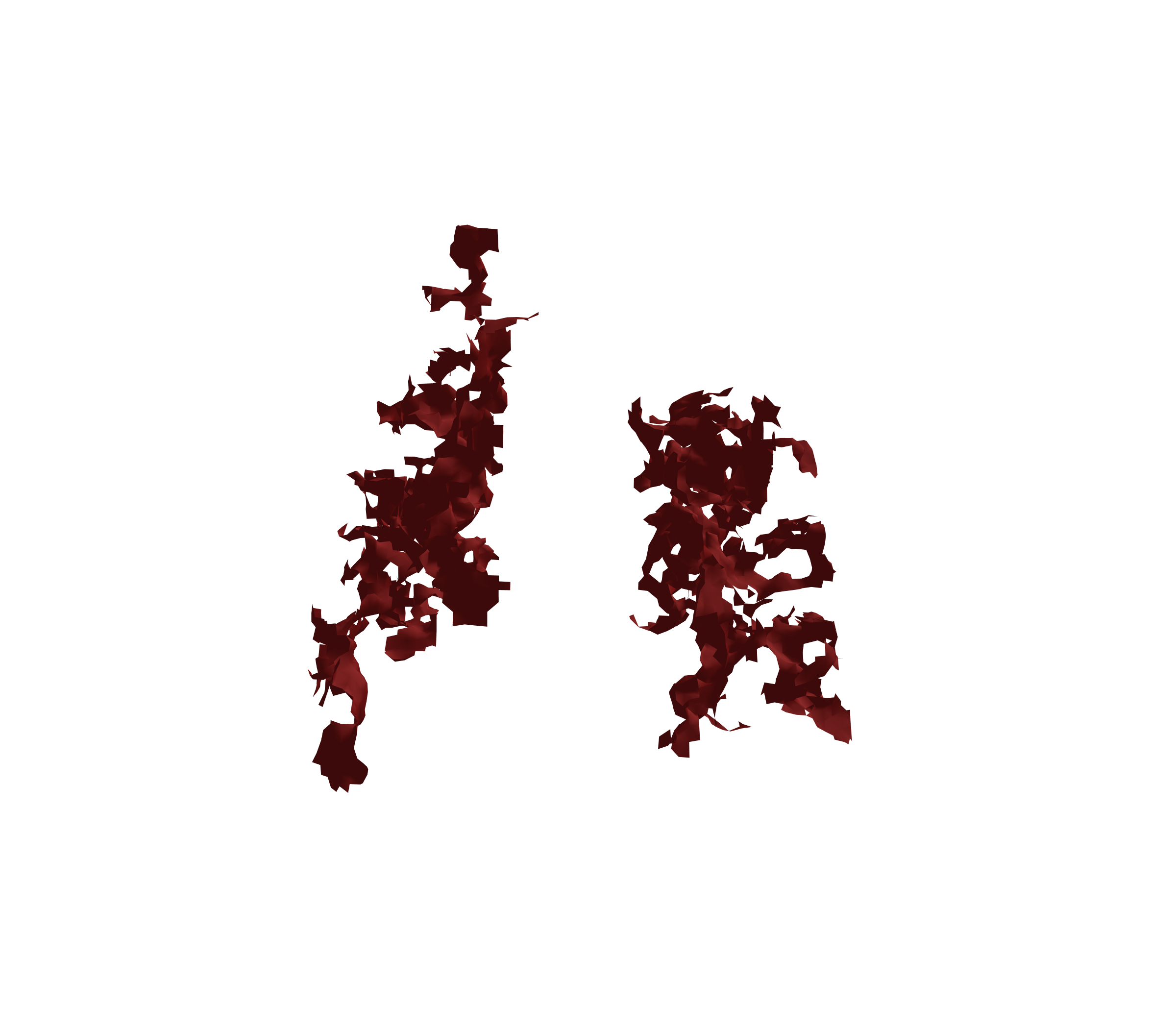 Surface Mesh (Expiration) - Back View