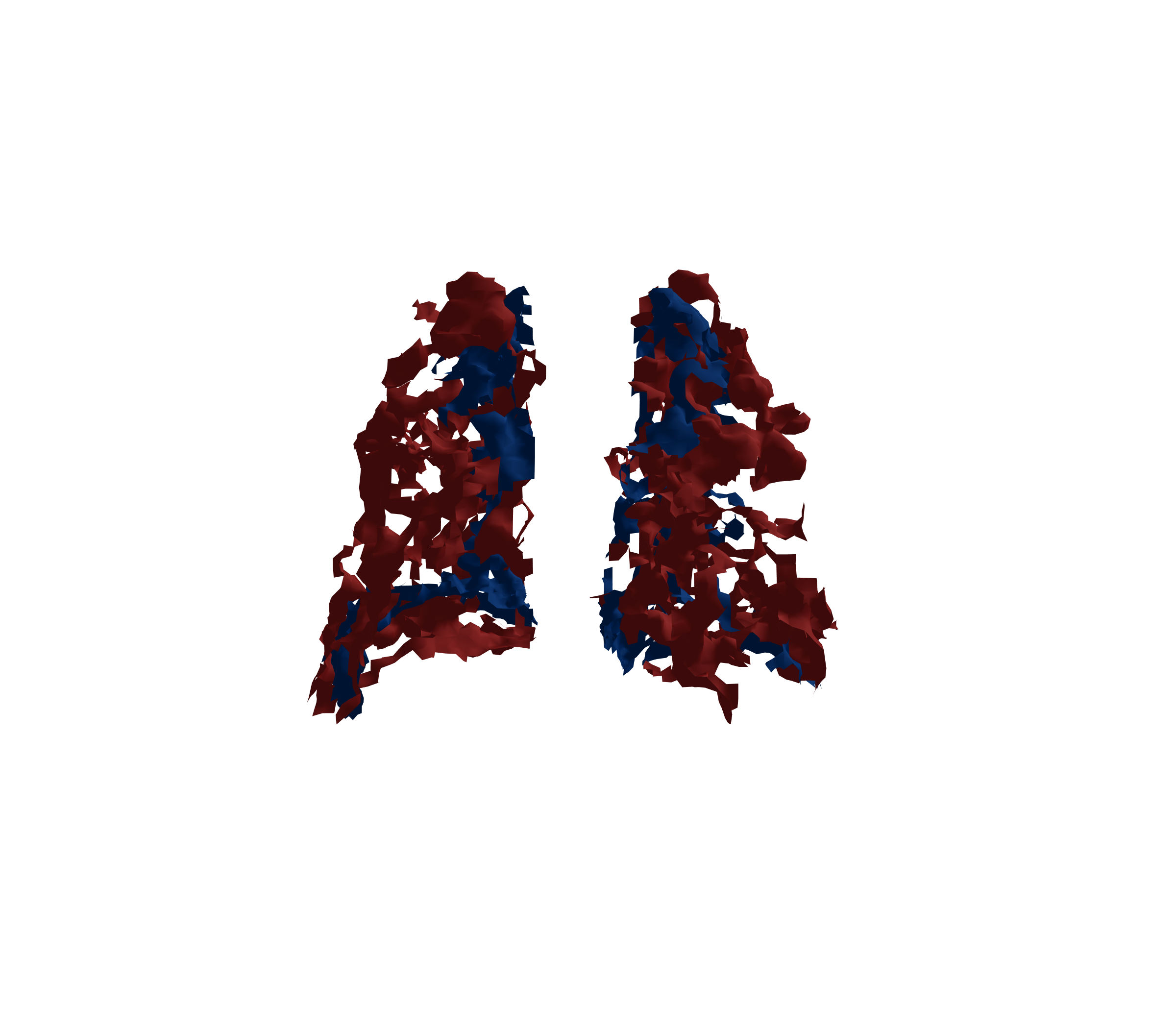 Surface Mesh - Back View