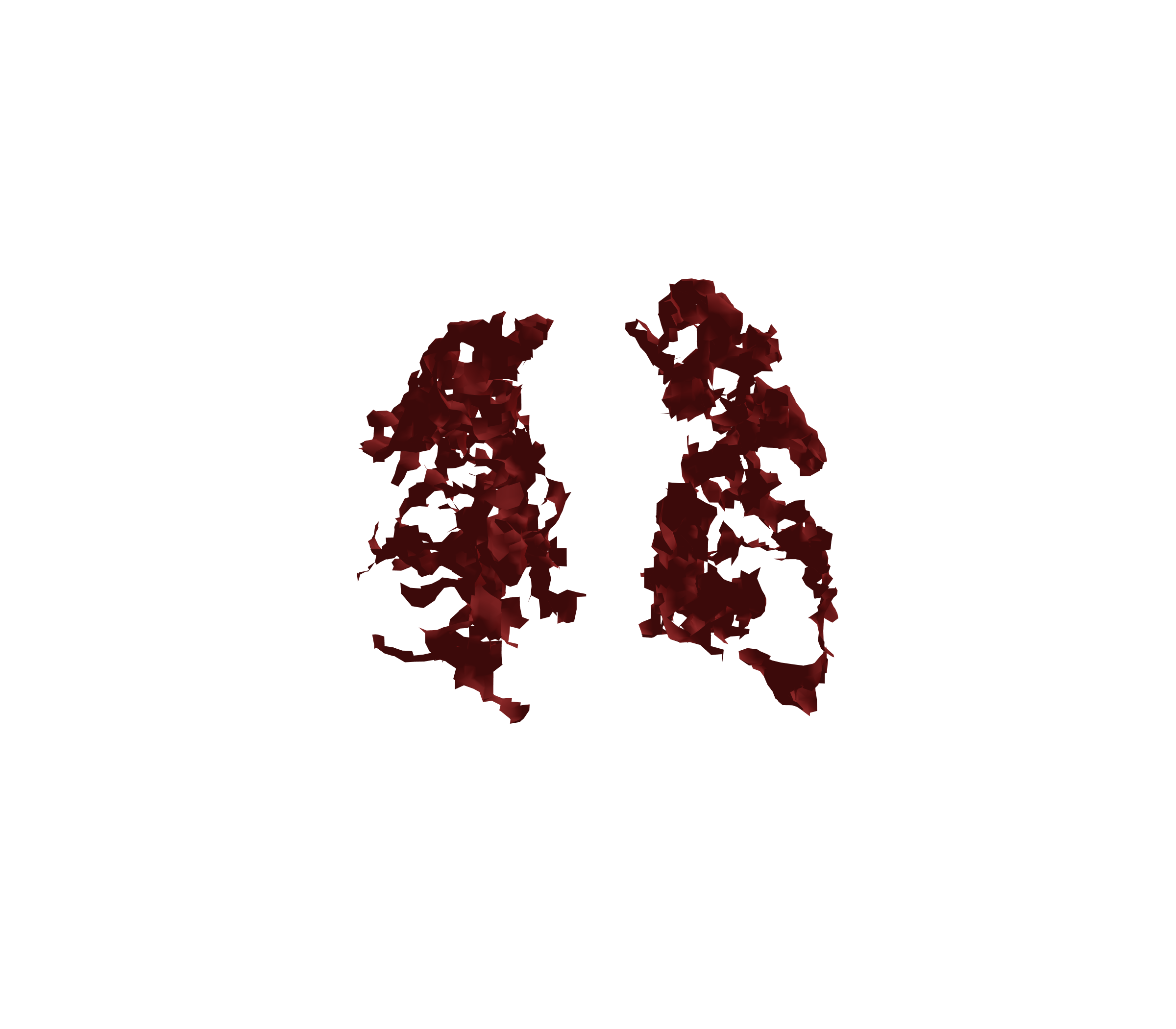 Surface Mesh (Expiration) - Front View