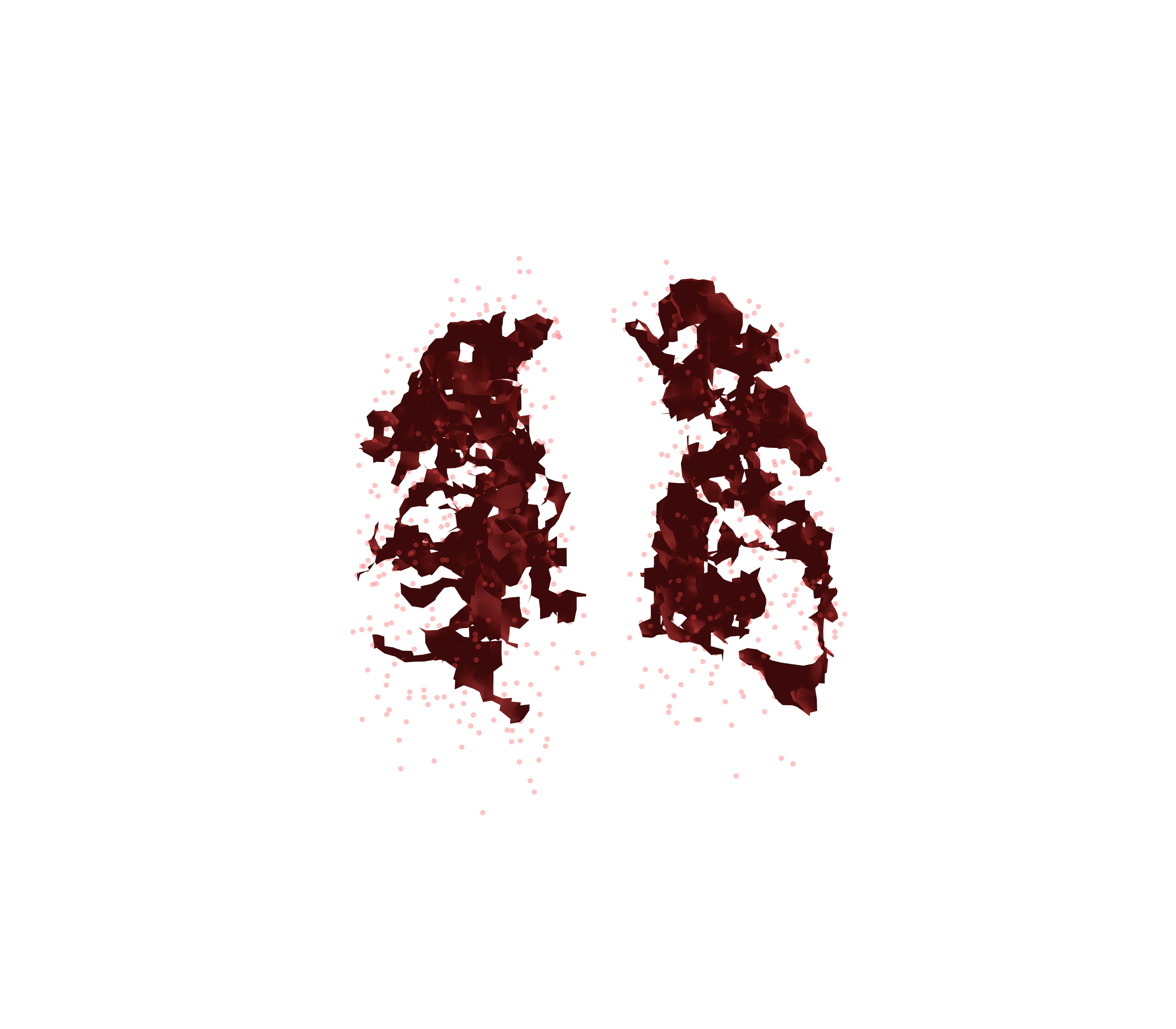 Combined Visualization (Expiration) - Front View