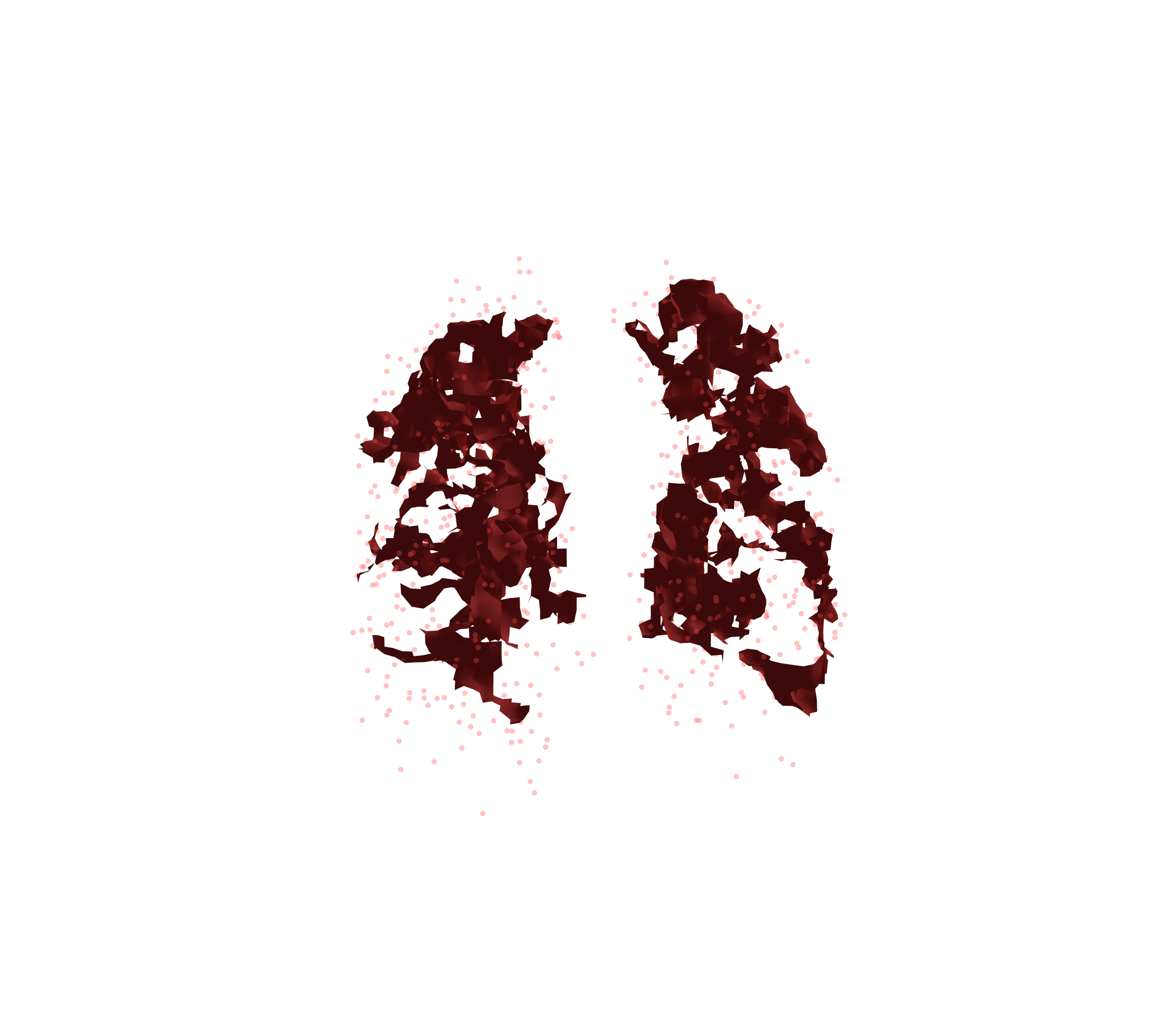 Combined Visualization (Expiration) - Front View