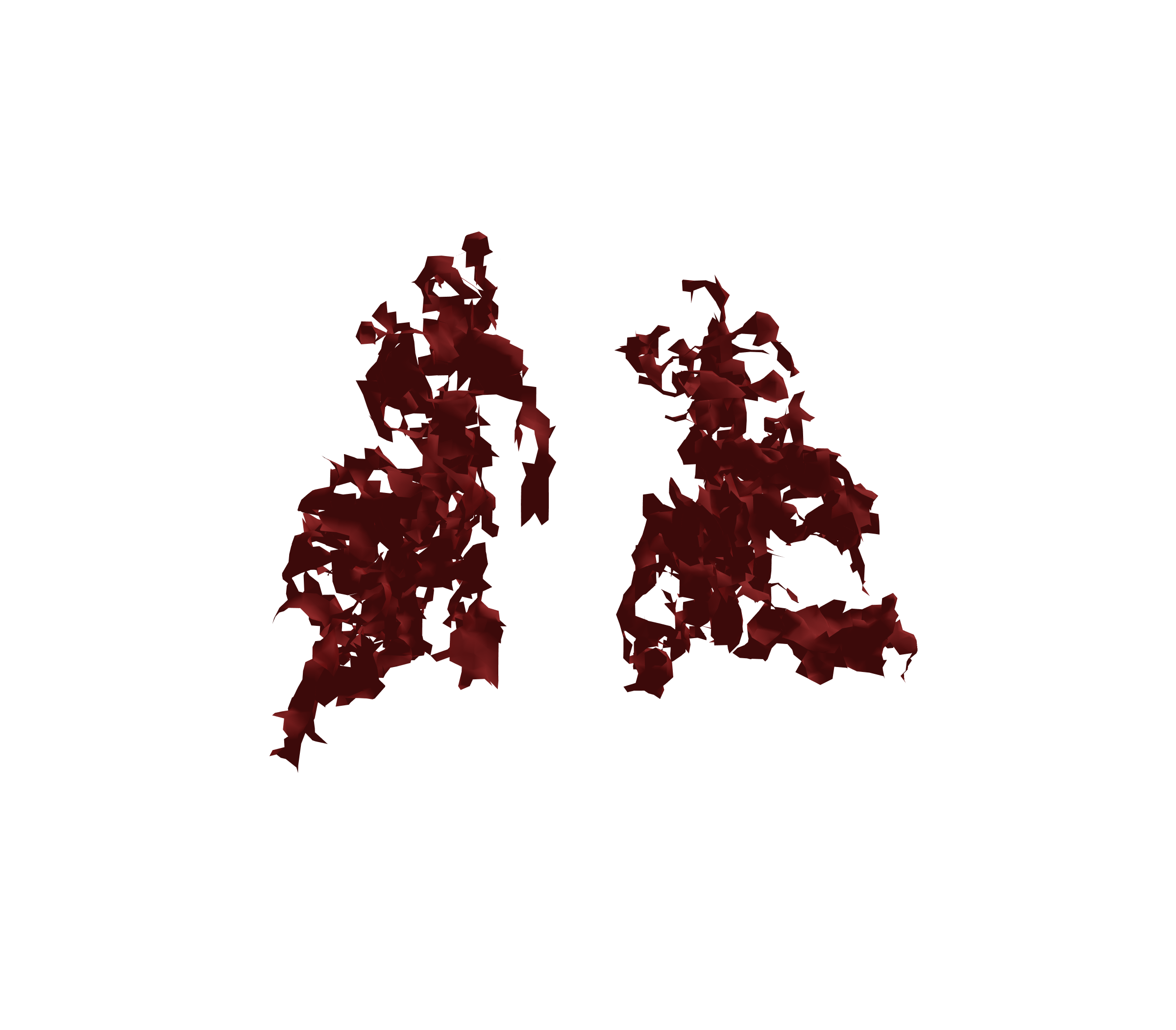 Surface Mesh (Expiration) - Back View