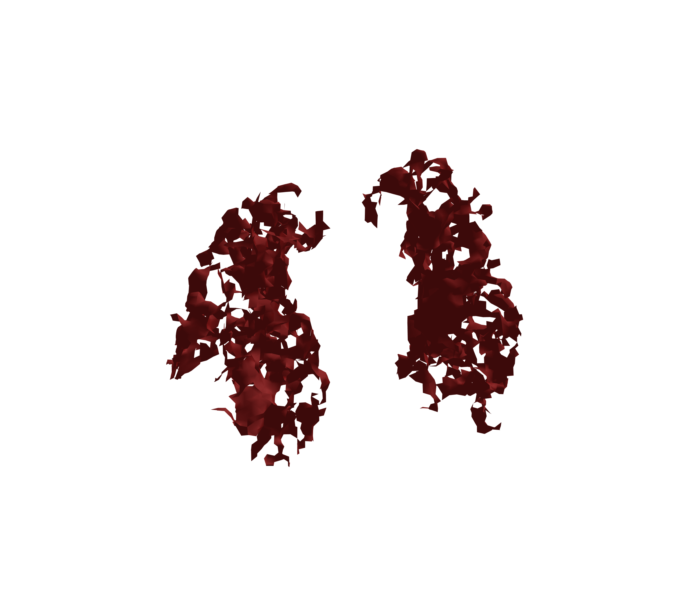 Surface Mesh (Expiration) - Front View