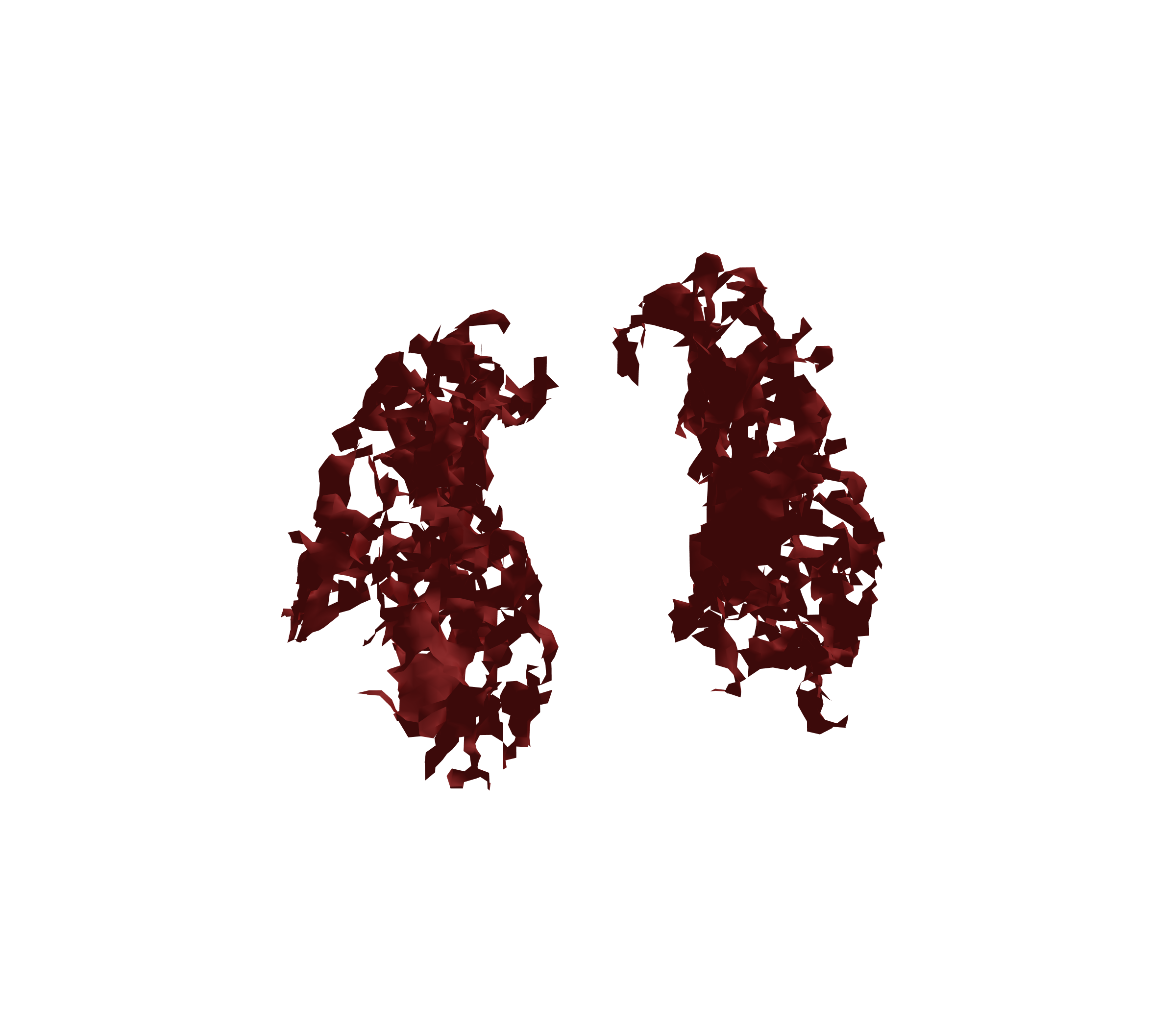 Surface Mesh (Expiration) - Front View