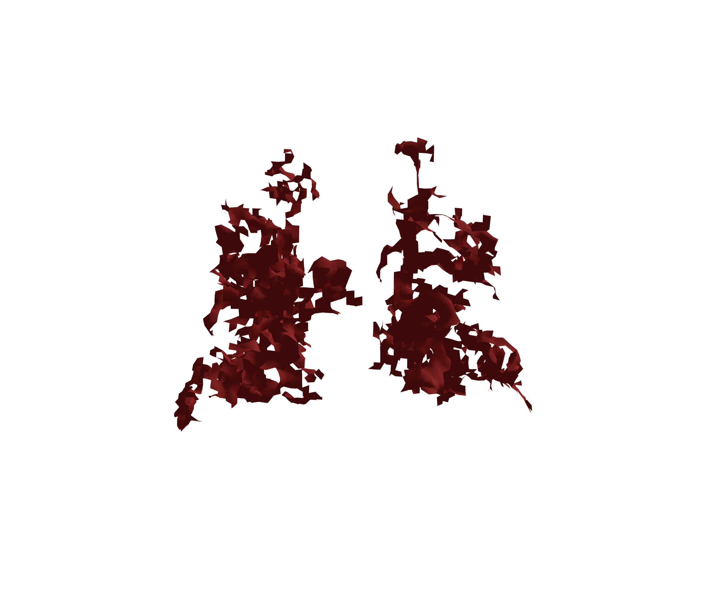 Surface Mesh (Expiration) - Back View